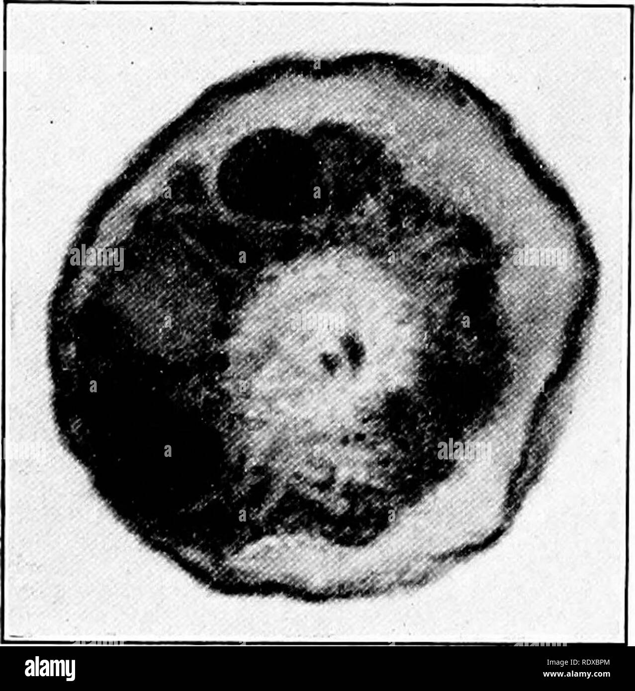 . Protozoo?. Protozoen; Protozoen, Pathogenen. 116 PROTOPLASMIC ALTER VON PROTOZOEN Die erste konkrete Beobachtungen, die nach chromidia Bildung wurden von Hertwig ('99) in Verbindung mit der Struktur des mit einer Schale versehenen rhizopod Arcella vulgaris. Zuvor hatten Beobachter fest, dass Chromatin-hke Granulat in der gesamten Zelle Körper distriljuted sind in vielen dieser Arten, aber Hertwig war der Erste, der der Ursprung des Materials aus dem Zellkern in arcella zu beschreiben und zu zeigen, dass es mit einem dichten Zone von Granulaten im Protoplasma (Abb. 44). Damals Hertwig beschrieben dieses Material unter der Stockfoto