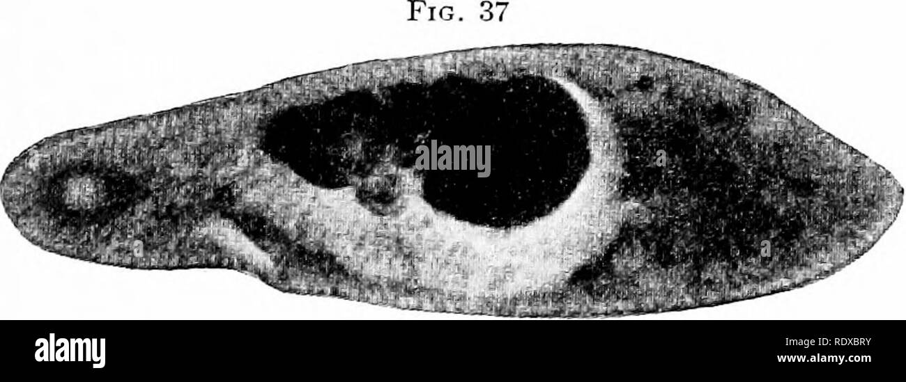 . Protozoo?. Protozoen; Protozoen, Pathogenen. Eine typische