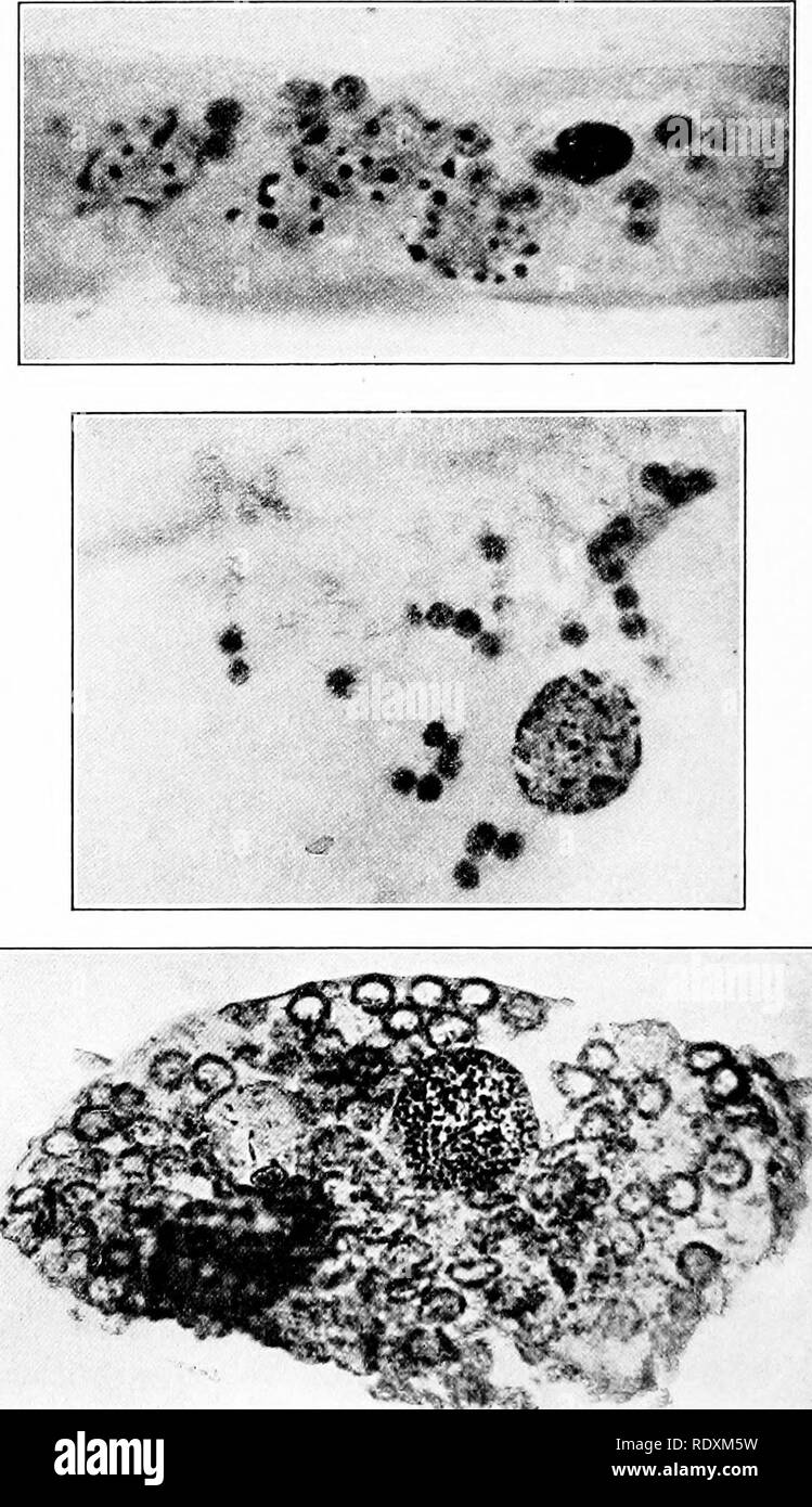 . Protozoo?. Protozoen; Protozoen, Pathogenen. 144 Konjugation, Reifung und Befruchtung wie folgt charakterisiert: Zwei bestimmt sind, als "Minus- Kerne, "Vier verkommen werden die Zentren von Shell Bildung der Sporen, vier Zentren der Pole Kapsel Bildung geworden, und vier bleiben, Abb. 00. Die autogamie in Amöben jn-oteu. s. In der oberen Ligure sekundär (gametic) Kernen gezeigt werden, die sich aus der primären Atomkerne. In der Abbildung wird dargestellt, der Union der togetlier gametic Kerne mit einigen unte' brannte in einem | u-imar. y-Kern. In der unteren Abbildung ist die Masse der siior sliown Stockfoto