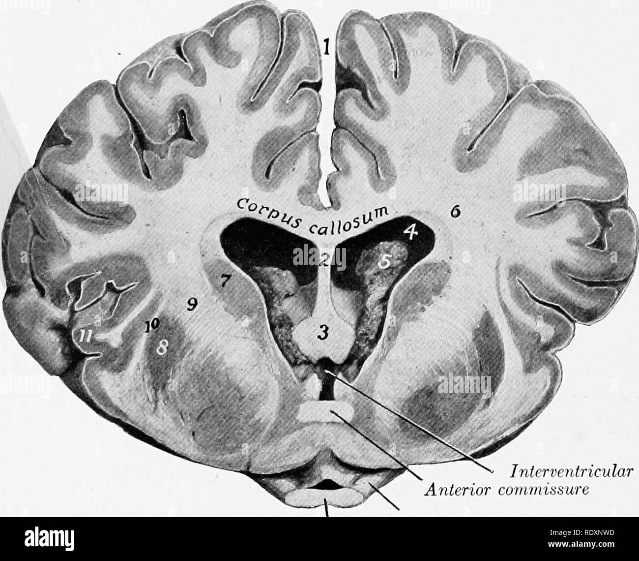 . Die Anatomie der Haustiere. Veterinär Anatomie. 790 NERVENSYSTEM DES PFERDES laterales)} Die ventrale Oberfläche die umgekehrte Konfiguration und bietet trans-vers Rippen und Rillen. Es bildet das Dach der lateralen Ventrikel, und das Septum pellucidum ist es medial befestigt. Die Fasern des Corpus callosum (mit Ausnahme der longitudinalen striaj) führen Sie quer und seitlich in alle Richtungen ausbreiten in der weißen Substanz des Hemisphären der ADR-tex, bilden die Strahlung des Corpus callosum (Radiatio corporis callosi). Die fornix ist ein Bila Stockfoto