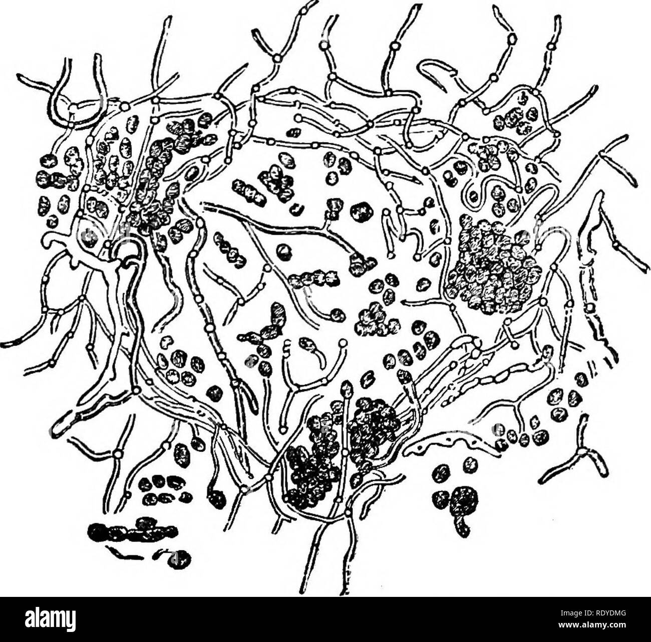 . Ein Handbuch der giftigen Pflanzen, vor allem des östlichen Nordamerika, mit kurzen Anmerkungen zu Wirtschafts- und Heilpflanzen, und zahlreichen Abbildungen. Giftige Pflanzen. FUNGI IMPERFECTI - SPOROTRICIIUM 297 Sporotrichum, Link Hyphen, Verzweigungen, die unregelmässig und wiederholt, septiert, oder kontinuierliche, üblich - gleich ly liegend; Konidien, acrogenous an der apices der Haupt- und seitliche Niederlassungen, die in der Regel alleine unter, ovale oder subglobose. Diese Gattung unterscheidet sich von Botrytis, insbesondere in allen die Hyphen, liegend und die konidien subsolitary; von Trichosporum, nie zu dunkel gefärbt. Sehr viele sp Stockfoto