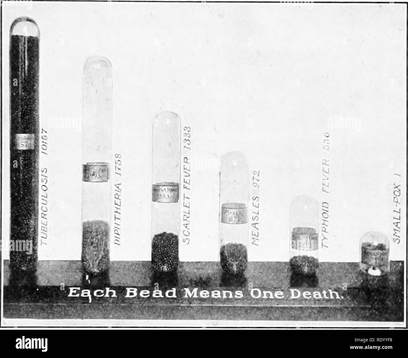 . Grundlagen der Biologie in Probleme. Biologie. Gesundheit und Krankheit 429 wir den speziellen Fall der Krankheit bekannt als Pocken betrachten. Im achtzehnten Jahrhundert 5.000.000 Personen sollen von ihm gestorben zu sein; vor hundert Jahren war es außerordentlich häufig in alle großen Städte in diesem Land. Zu-Tag eine Epidemie der Pocken ist Impos möglich, dank der Entdeckung der Impfung und ein sofortiges Eingreifen durch die Gesundheit Abteilung. Tuberkulose in der heutigen Zeit tötet jährlich mehr Menschen als jede andere Krankheit, und doch ist es von Sanitär hving glaubten wir Stempel wird die Krankheit innerhalb von 50 Stockfoto