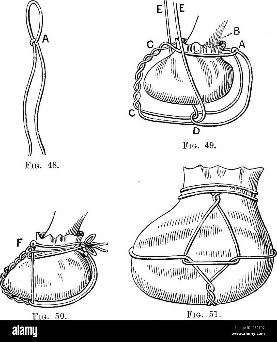 . Krankheiten des Pferdes. Die hufe; Pferde. OPEEATIONS AUF DEM FUSS 87 Runde in der ordentliche Weg, die Schleife der Netzkabel an der Rückseite der Vordermittelfuß gelegt wird (wie in A, Abb. 49); die Enden der Schnur vergangen sind rund, eine auf der Innenseite und der andere auf der Außenseite, in Richtung der Vorderseite (wie in B, Abb. 49). Diese Ziele werden dann zusammen nach unten Gezwirnter so weit wie der Toe (siehe C in Abb. 49). Der Fuß ist jetzt aufgehoben, und die Enden. Abb. 51. Abbn. 48, 49, 50, 51.-Illdsteating Lieutenant-Colonel Nunn's Methode der Anwendung ein POULTICE auf den Fuß. der Schnur (CO, Abb. 49), sind durch die Schleife ein (wie Stockfoto