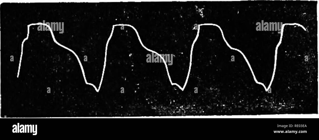 . Der Physiologie der Tiere; ein Lehrbuch für tierärztliche und medizinische Studenten und Praktiker. Physiologie, Vergleichende; Haustiere. 546 PHYSIOLOGIE DER HAUSTIERE.. Abb. 228.-Puls-Tracing op's der Frosch Herz. (Sanderson.) Pulsieren des Herzens die Spalte von Quecksilber Waschbecken in einen Arm des Manometers, obwohl es einen entsprechenden Abstand in den anderen steigt, mit sich trägt den Kolben, der durch seine pen Spuren einer Zeile besteht aus einer Folge von Kurven auf der geräucherte Oberfläche der rotierenden Trommel. Die aufsteigenden Teil Der jede Kurve entspricht der systole der Stockfoto