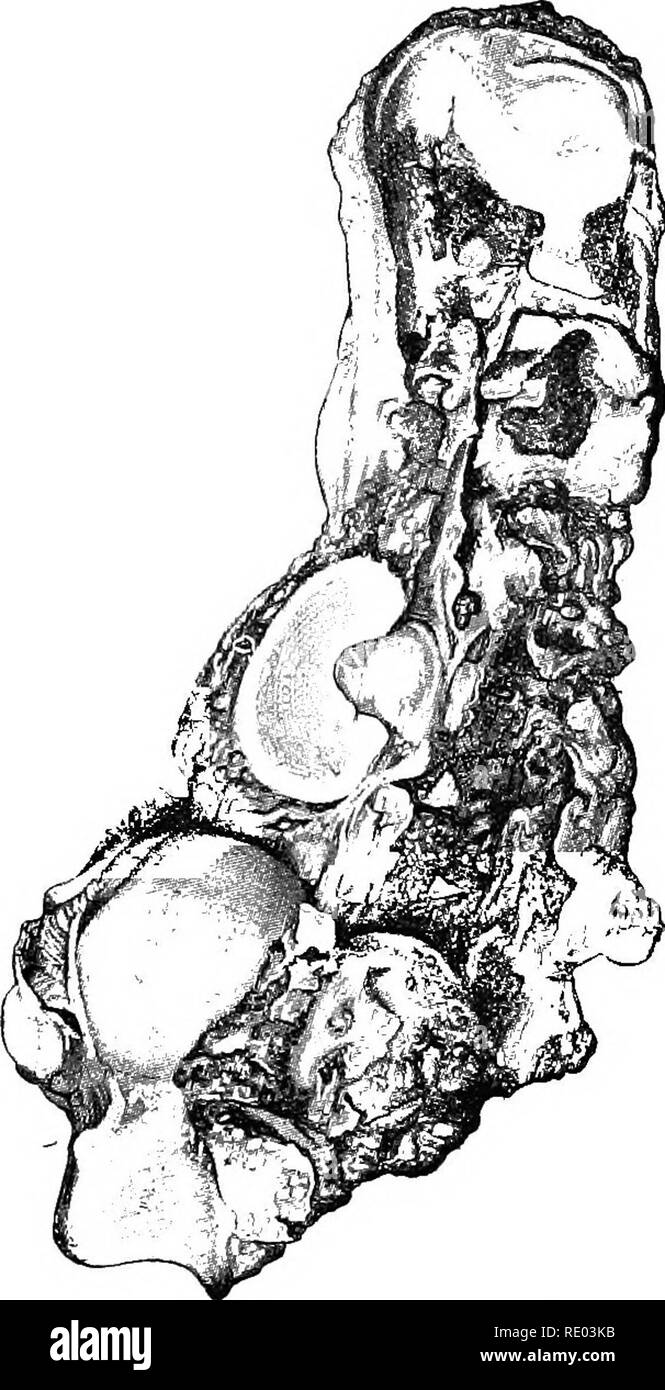 . Erkrankungen von Rindern, Schafen, Ziegen und Schweinen. Veterinärmedizin. Ansteckende PSEUDO-RHEUMA BEI ERWACHSENEN. 101 Durch die Schwierigkeit steigt, und bald danach von Lahmheit, oder durch das Tier nicht Gewicht auf einem der hinteren Gliedmaßen zu platzieren. Das betroffene Gelenk, in der Regel einer der Artikulationen des ersticken, erscheint deutlich vergrößert, ist nicht deutlich zu heiß, sondern zeigt eine gewisse Menge an. Bitte beachten Sie, dass diese Bilder extrahiert werden aus der gescannten Seite Bilder, die digital haben für die Lesbarkeit verbessert - Färbung und Aussehen dieser Abbildungen können nicht Perfekt resembl Stockfoto