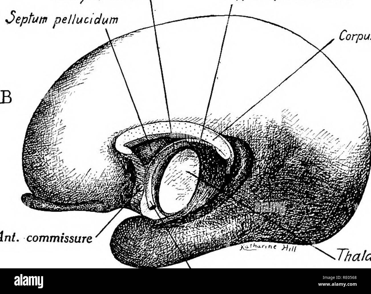 . Ein Labor Hand- und Lehrbuch der Embryologie. Embryologie. Hippocampus commissure Anterior commissure Antpillars der fornix orwid riss Thalamus Körper des Hippocampus fornix Septum pellucidum commissure Corpus callosum. Ant. Commissure' - Thalamus Ant. Säule der Form *Abb. 333 - zwei Phasen in der Entwicklung der cerebral Commissure. A, Mittlere Ansicht der rechten Hemisphäre eines 83 mm. Embryo; B, der ist von einem 120 mm. Embryo. (Auf Rekonstruktionen von Seinem und Streeter). Die Fasern der anterior commissure Kreuz in der Lamina terminalis ventral der Hippocampus Commissure. Sie entstehen als Stockfoto