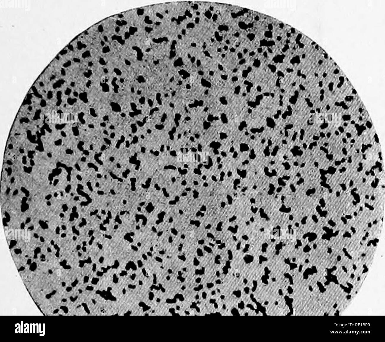 . Ein text-Buch auf die pathogenen Bakterien und Protozoen für Studenten der Medizin und Ärzte. Bakteriologie; pathogenen Bakterien und Protozoen. Bazillen, die den Tuberkelbazillus 737 S., dass die Bezeichnung "bazillus" als zu dieser Gruppe von Bakterien und der Erreger der Tuberkulose angewendet wird, irreführend; sie sind mehr korrekt klassifiziert als actinomyceten. Die Butter Bacillus Petri, * Rabinowitsch, t und KornJ haben beschrieben, wie Bacillus butyricus, eine Säure - schnelle Organismus morphologisch Wie der tuberkelbazillus, die bisweilen in Butter gefunden werden. Seine Bedeutung liegt in der Stockfoto