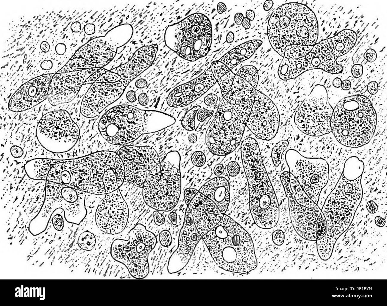 . Ein text-Buch auf die pathogenen Bakterien und Protozoen für Studenten der Medizin und Ärzte. Bakteriologie; pathogenen Bakterien und Protozoen. Amebic Ruhr 673 I. AMEBIC DYSENTERIE Amceba Coli (Losch, 1875); Amceba Dysenteric (Länder und cilman Lapleur, 1893); Entamoeba Histo-lytica (ScHAupiNN, 1903) wie in der Abbildung gezeigt wurde, Amebas wurden erstmals in der menschlichen In-testine durch Lambl. Ihre Anwesenheit und die wahrscheinliche Bedeutung in dys-entery wurde in der Folge durch Losch, Koch, Gaffky, Kar-tulis, Korbweiden, Stadtrat und Lafleur, und viele andere. Und CeUi Fiocca * waren die Ersten, die das Amebas zu studieren Stockfoto