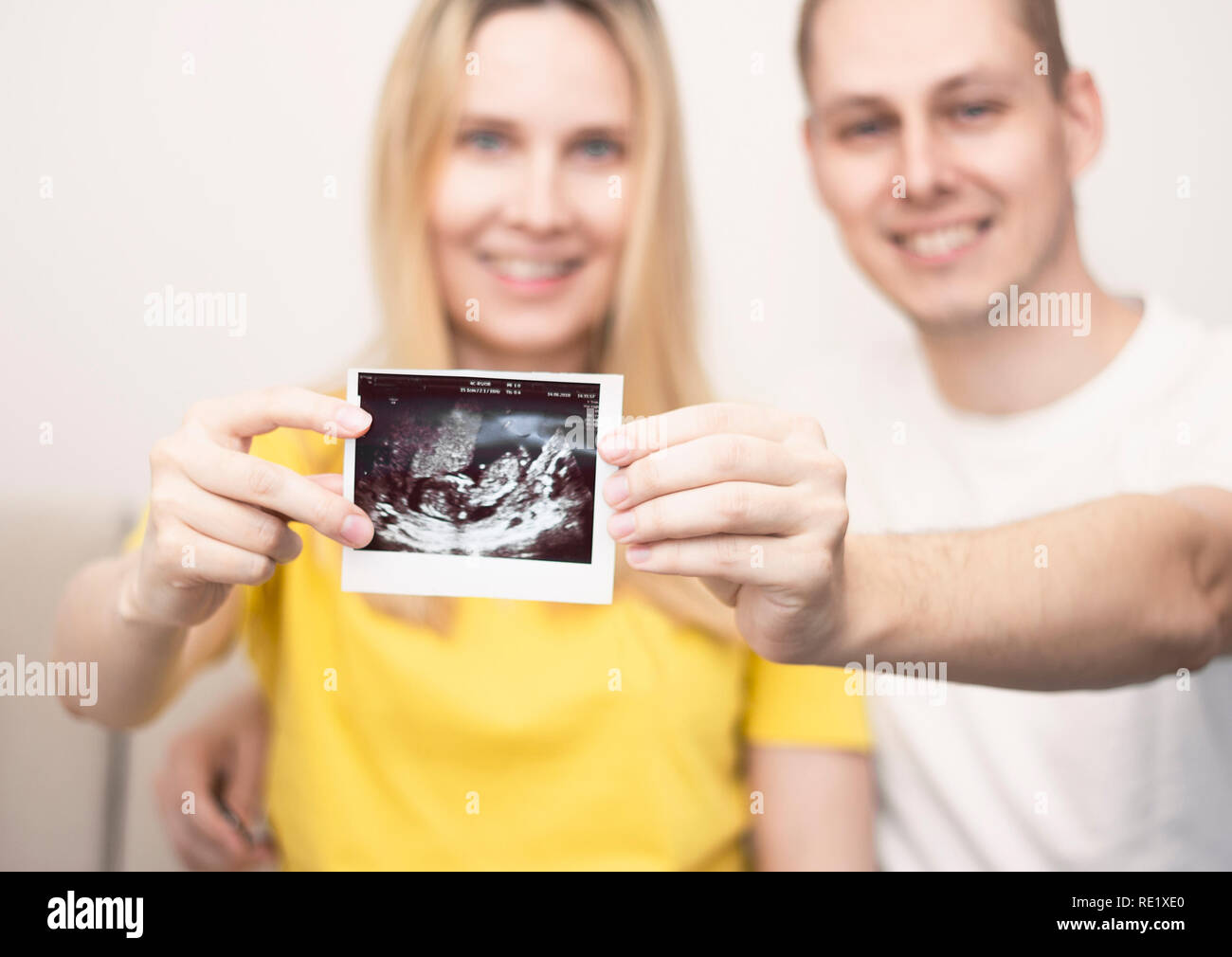 Glückliches junges Paar hält Ultraschallbild Ihres Babys. Stockfoto