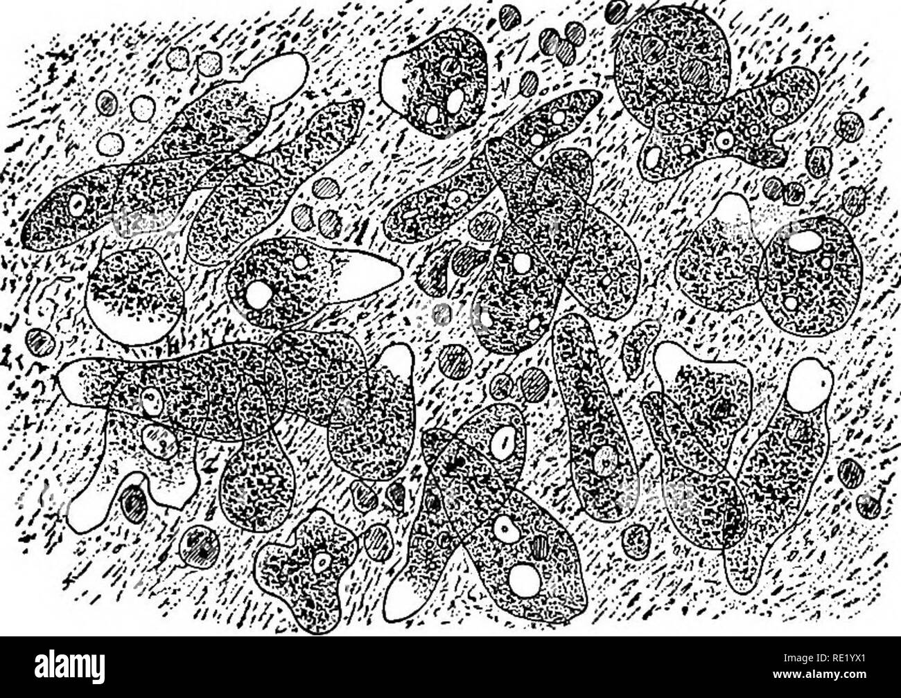 . Ein text-Buch auf die pathogenen Bakterien und Protozoen für Studenten der Medizin und Ärzte. Bakteriologie; pathogenen Bakterien und Protozoen. Amebic Ruhr 633 I. AMEBIC DYSENTERIE Amceba Coli (Losch, 1875); Amceba Dysenteri^e (Stadtrat und LaM - EUR, 1893); ENTAMffiBA HISTOLYTICA (SCHAU-DINN, 1903) wie gezeigt wurde, Amebas wurden erstmals in der menschlichen In-testine durch Lambl gefunden; in der Dysenterie, durch Losch, Koch, Gaffky, KartuUs, Korbweiden, Stadtrat und Lafleur, und viele andere. Die willkommen schließlich, die der Organismen als excitants der Ruhr wurde Sufi & Amp; zient enthusiastisch für zu kompensieren Stockfoto