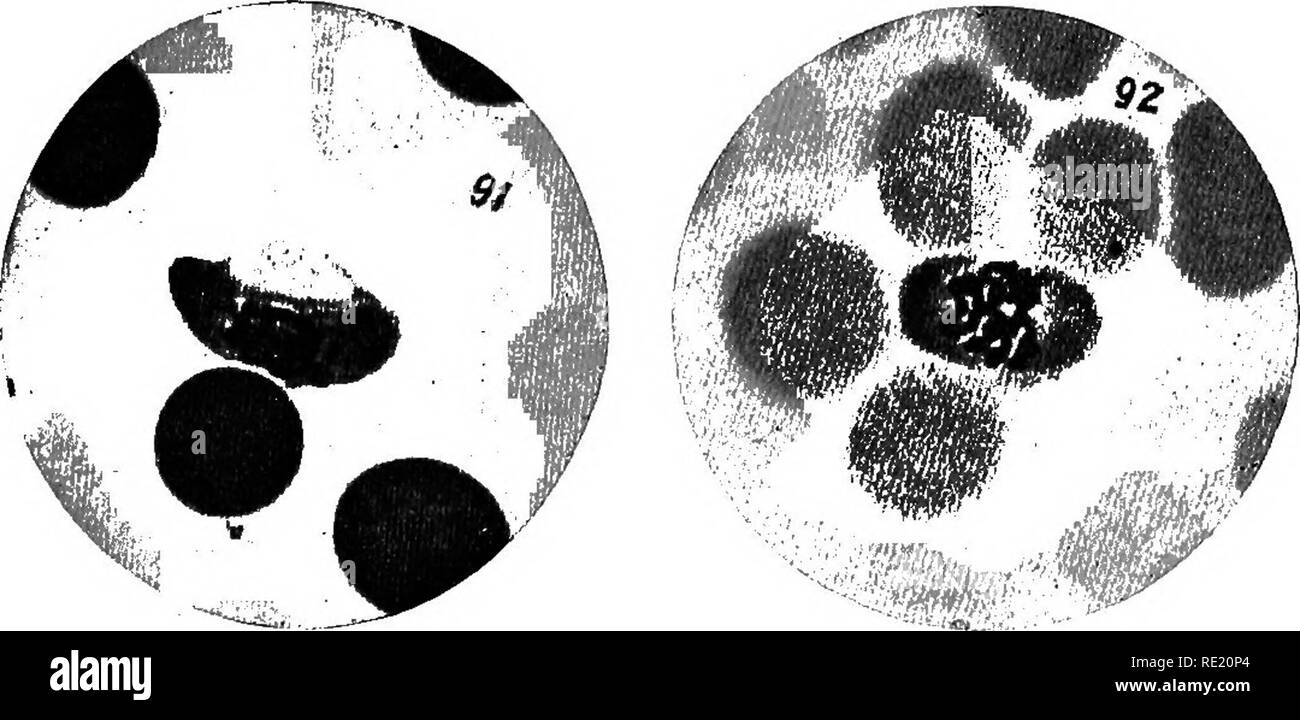 . Ein text-Buch auf die pathogenen Bakterien und Protozoen für Studenten der Medizin und Ärzte. Bakteriologie; pathogenen Bakterien und Protozoen. Die menschlichen Malariaparasiten 483 aber in der Größe kleiner. Das Pigment ist in der Mitte in ein wenig Masse versammelt, und acht bis 25 merozoits sind in einer morula oder Mulberry gebildet - wie Masse ähnlich denen Der tertian para-Site. Zwei oder drei Parasiten in die korpuskel sind häufig. Sie sind aktiv ameboid, nicht gleichzeitig Reifen und daher 9 Abb. 187.- Parasiten der estivo-herbstlichen Fieber: a, b, c, Ring - wie Kreuz - wie hyalinen Formen; d, und Stockfoto