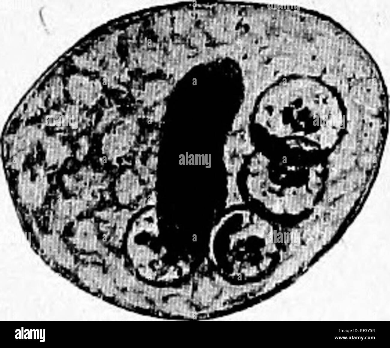 . Pathogene Mikroorganismen. Ein text-Buch der Mikrobiologie für Ärzte und Studenten der Medizin. (Auf Williams' Bakteriologie). Bakteriologie; pathogenen Bakterien. 424 SPEZIFISCHE MIKROORGANISMEN andere Einzelpersonen. Die Zelle ist 8 bis 60/i im Durchmesser. Die ecto - keimplasma ist deutlich von der endoplasm differenziert, auch wenn die Zelle unbeweglich ist, und der lobose pseudopodia sind völlig von Stiff hoch refraktive Ektoplasma.   Die endopla' fem enthält Essen Material bestehend aus Bakterien, Zelle, Fragmente und roten Blutkörperchen. Der Kern ist sehr deutlich sichtbar in der lebenden Amöben Stockfoto