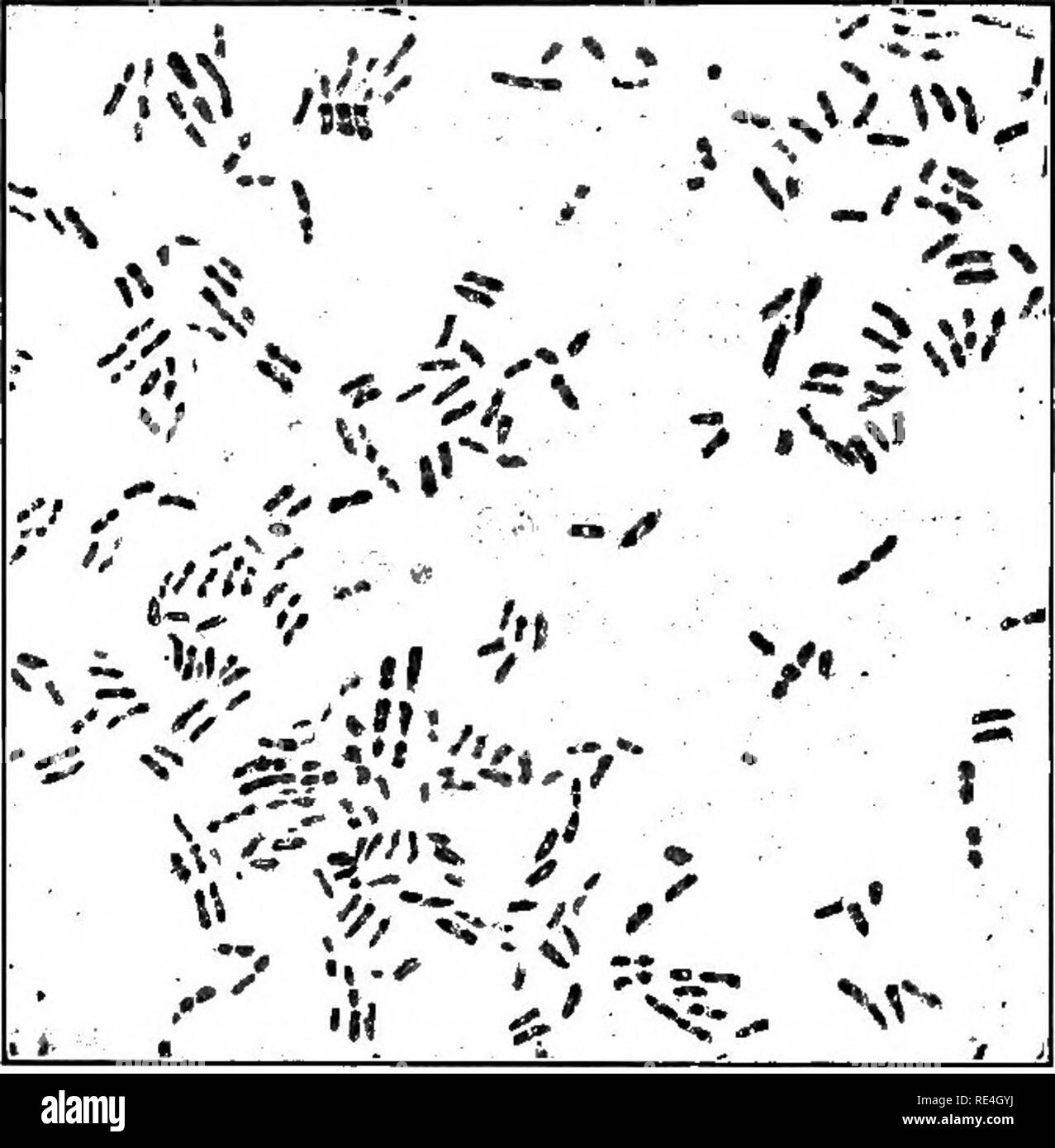 . Ein text-Buch auf die pathogenen Bakterien und Protozoen für Studenten der Medizin und Ärzte. Bakteriologie; pathogenen Bakterien und Protozoen. 43°Diphtherie Zeile anstatt eine saure Reaktion, indem sie ihr Wachstum in Bouillon. Die pseudo-diphtheriebazillen in etwa ich Prozent, von Kehlen in New York untersuchten gefunden wurden; sie scheinen keine Beziehung zu diph-theria zu haben, und sind nie virulent. Morphologie.-- Dieser Mikroorganismus trägt eine mehr oder weniger deutliche Ähnlichkeit mit Bacillus diphtheriae-, unterscheidet sich aber in bestimmten Angaben, in der Regel machen es möglich, zu erkennen und zu identifizieren. Es ist kürzer und Stockfoto