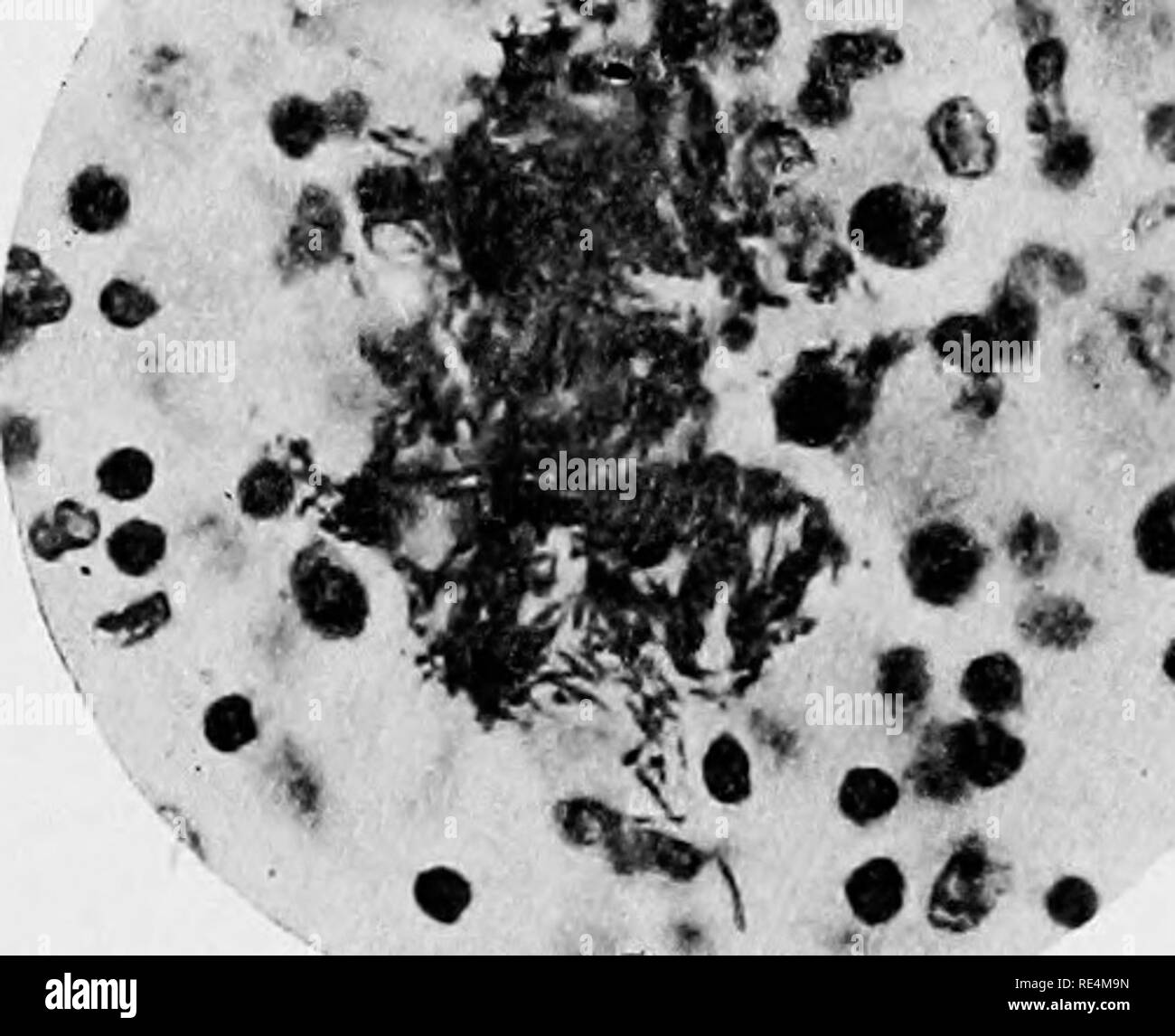 . Handbuch der Bakteriologie. Die Bakteriologie. 320 TYPHUS. Frage der morphologischen Beziehungen der beiden Organismen ist ein wichtiger Teil in der bakteriologischen Untersuchung des Themas gespielt. Es hat viel Kontroverse darüber, ob sie Sorten der gleichen Art, deren Ergebnis wächst die Überzeugung, dass die beiden wirklich verschieden sind. Der Bazillus Typhosus. Â mikroskopische Erscheinungen. "Es ist manchmal schwierig zu finden ist der Typhus Bazillen in den Organen eines Typhus Patienten. Zahlreiche Abschnitte der einzelnen Teile der Milz kann beispielsweise geprüft, bevor ein. Stockfoto