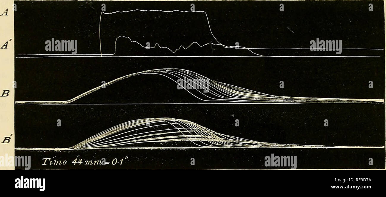 . Beiträge für die Studie über den Zusammenhang zwischen chemischer Struktur und physiologische Wirkung. Biochemie und Physiologie. 574 DBS. T.L. BRUNTON UND J.T. BARGELD AUF DER VERBINDUNG Abb. 9. Aktion des Amidobenzene (Anilin) in Muskel- und Nervenzellen. A, Tetanus aus unligatnred (Vergiftung) Bein durch direkte Stimulation für 5 s auf. A',,,, "indirekte"" (d. h., Stimulation von Nervenzellen). B, 30 wehen im Abstand von 2 Jahren von der direkten Stimulation. B',,., "indirekte" der Frosch wog 30 grms. Es war Decerebrated; die linke Darmbein Schiffe ligatured; und 1 min von amidobenzene in Fsme-dorsalen l gespritzt Stockfoto