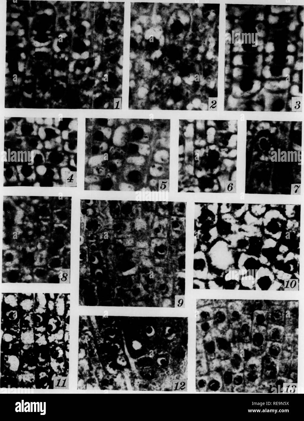 . Beiträge der botanischen Labor und der Morris Arboretum der Universität von Pennsylvania, Vol. 13. Botanik; Botanik. Juli, 1936] EDWARDS - ZYTOLOGISCHE UNTERSUCHUNGEN DER TOXIZITÄT Tabelle 1. Zusammenfassung der Wirkungen des neutralen Salze auf verschiedene Teile des ccll.^ 487 Abb. 1 - 3. Alle Zahlen repräsentieren und.fforontiatod colls aus der Region immodiafolv initiil hohind Tho. Die Vergrößerung ist 838 Durchmesser. Abb. 1-8 zeigen Tho basic Fixierung Bilder von Chromsäure suli. hafo-formalen. lVh Tlo follovnm "varioiK angezeigt. treanionts, während Abb. 9-13 zeigen tho Säure Bilder Der liouin Fixiermittel.-Abb. 1. (V Stockfoto