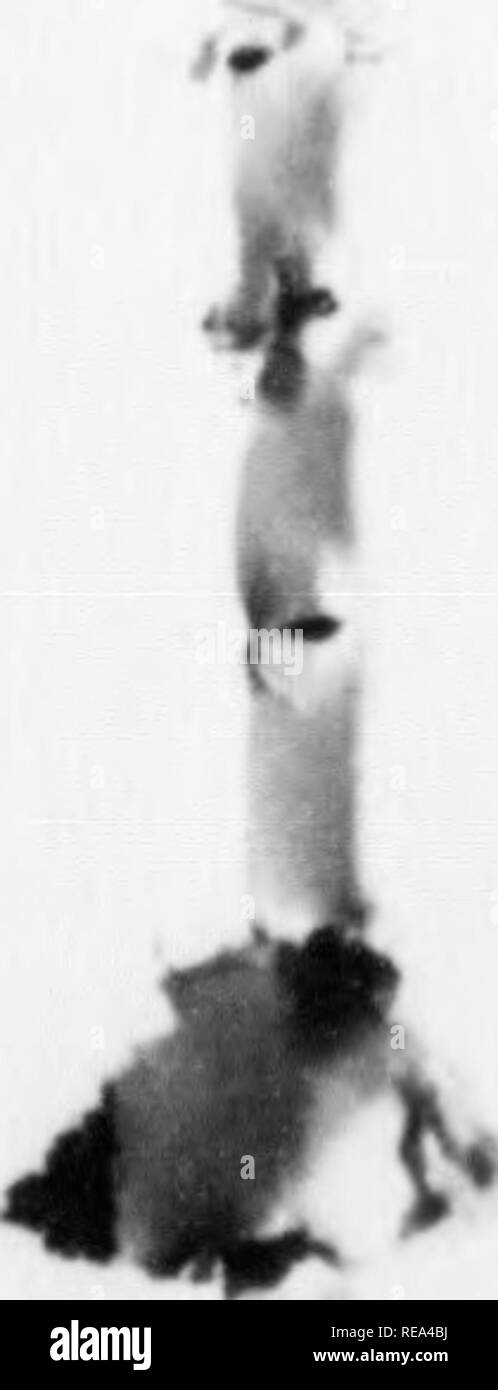 . Beiträge der botanischen Labor, Bd. 7. Botanik; Botanik. Abb. 6. Hypertrophisierten Zelle in Alten (8 Tage) Kultur der Jensens Ratten Sarkom angezeigt, A-Aggregation von Fett, B - die etwas eckig (hexagonal) Form der Fettkügelchen und C - die Pseudo-alveolarer Struktur, die entsteht, wenn die Zelle ist fest verlassen" fettvakuolen". (Von Zubereitungen von Miss Strangeways und mit ihrer freundlichen Erlaubnis veröffentlicht. d. Es kann behauptet werden, dass eine Anhäufung von Fett, auch wenn ausreichend kompakt Sie polygonalen zu werden, ist nicht das, was gemeint ist durch alveolären Protoplasma. Eine solche Stockfoto