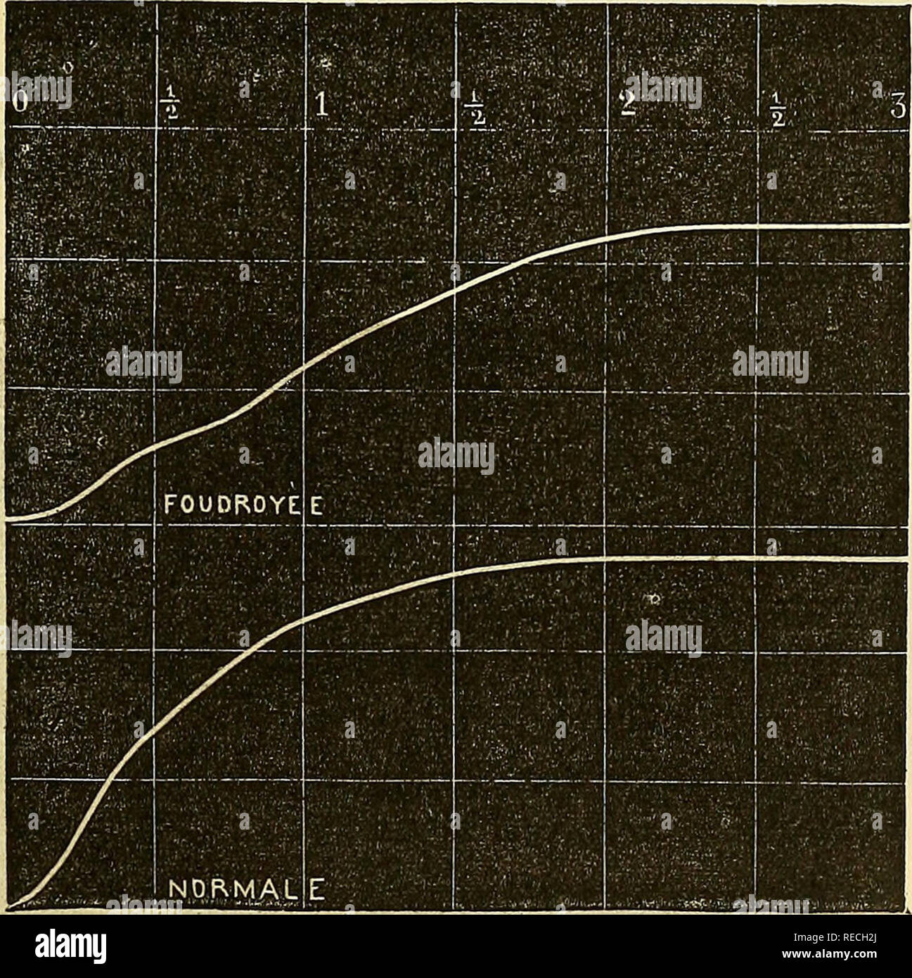 . Comptes Rendus de Séancen de la Société de Biologie et de ses filiales. Biologie. Abb. 2. - Einfluss du Passage. d'une étincelle électrique sur la Fermentation. Passage des étincelles d'Induktion est sans Einfluss sur la Marche d'une Gärung. Il n'en est plus de même si on procède autrement. Sur de la levure. Abb. 3. - Einfluss de Grandes étincelles sur la levure de bière. Humide, Nous avons, Pendant cinq Minuten, envoyé Les décharges d'une Grande bobine Donnant des étincelles centimètres de 30 de Lange. Nous avions pris toutes Nos précautions pour que la levure ne s'échauffer pût. Pl Stockfoto