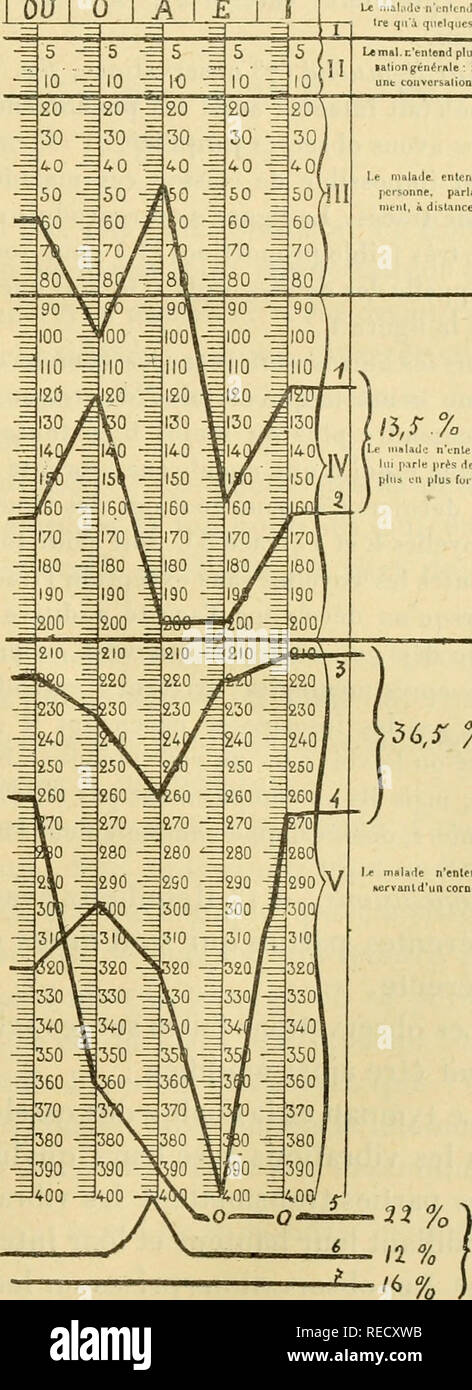 . Comptes Rendus hebdomadaires des sÃ© ances de l'AcadÃ©mie des Sciences. Wissenschaft - Gesellschaften, etc.; Wissenschaft; Wissenschaft. OU I0 I A I Â £ Le nialiidc - n'cntcn.) j. lus La rcion-Ire qu'à quelques cenlintÃ ¨ lres. L "mal, ich: "tntend plus uoeconvfr - laliong^ nÃ©tTile: Il entend bien unt tonvorsalion parlicLil. Ãªre. D.h. malade, Entend une seule Personne, parlant distincte - nient, H Entfernung normale. S. %c iiinlail&lt;: n'entend que Si auf Lin s. irle prÃ¨s de l'oreille et de Pilla cil plus unerlaubter Handlung.. 56, r%jt nifllade n'entend qu'en Â"Â" itervanld'un cornetacousliqus. ^0% SclÃ © Rose. - Surcli miititÃ ©. Les c Stockfoto