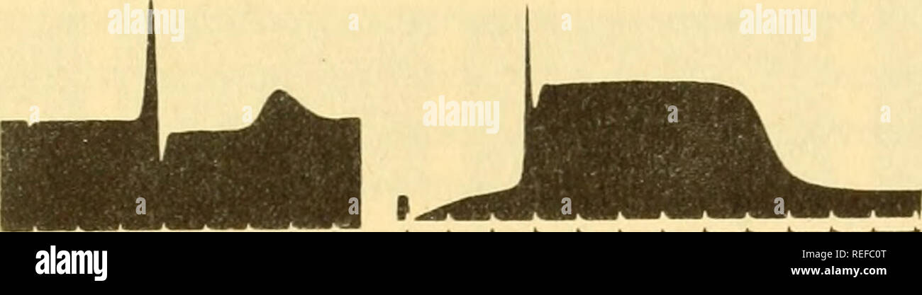 . Vergleichende Tierphysiologie. Physiologie, Vergleichende; Physiologie, Vergleichende. Abb. 222. Aktionspotenziale von nictitating Membran von Cat: a/d, Kurven, die sich aus steigenden Intensitäten von Reizen. Eccles und Magladerry."^^. A B Abb. 223. Aktion Potentiale aus der ureter der Ratte: A, diphasic, und B, monophasische Datensatz mit Elektroden 1 mm auseinander. Bozler.'^in der nictitating Membran der Katze einen Nerv volley unzureichend zu entlocken eine Kontraktion stellt eine langsame negative Welle (N), der mav Letzten 10 msec. (Abb. 222); Schwelle volleys entlocken größeren negativen Wellen, die zu b angezeigt Stockfoto