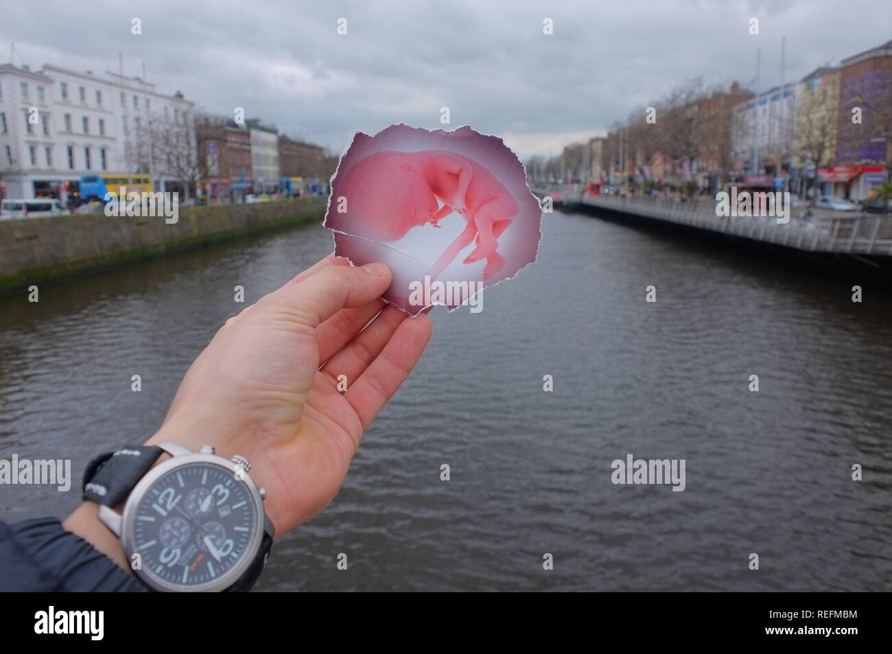 Gegen Abtreibung protestieren Stockfoto