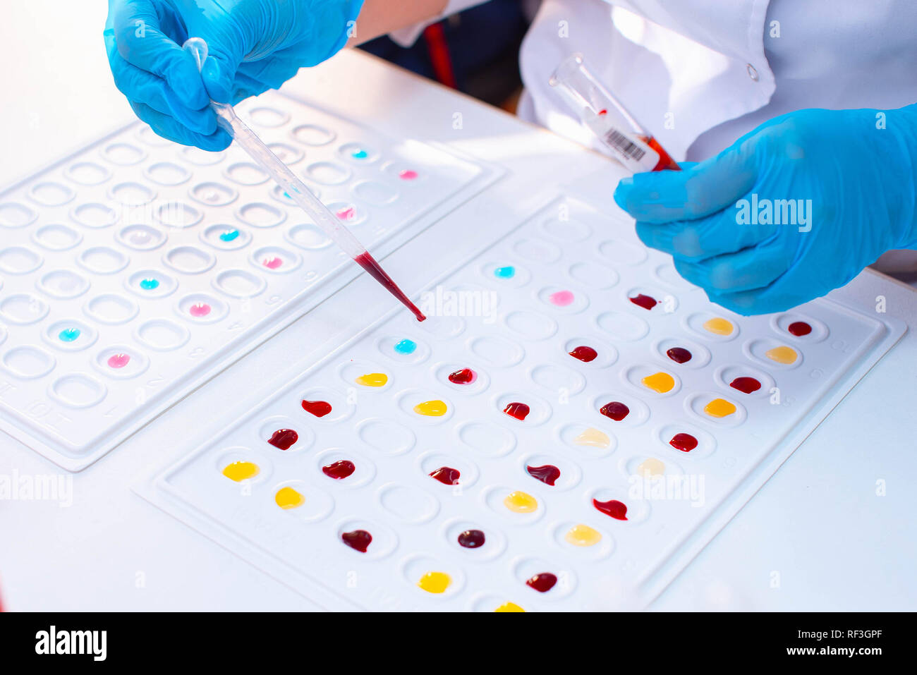 Labor Bestimmung der Blutgruppe. Blutprobe. Stockfoto