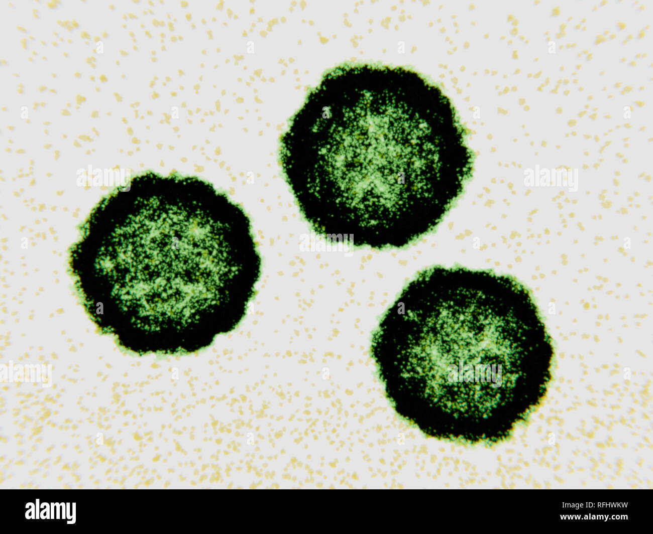 Coxsackievirus Viruspartikel, Illustration. Coxsackievirus Viruspartikel (Virionen) bestehen aus einer äusseren Proteinmantel (Kapsid) begrenzenden RNA (Ribonukleinsäure), das genetische Material des Virus. Coxsackievirus ist eine Art von Enterovirus. Es gehört zu den häufigsten und wichtigsten menschlichen Krankheitserregern, wodurch Erkältungen, virale Meningitis und myokarditis. Die Infektion breitet sich von Person zu Person, in der Regel auf ungewaschene Hände und Flächen mit Fäkalien, wo das Virus für mehrere Tage leben können verunreinigt. Coxsackie-viren sind unterteilt in Typ A und Typ B, Typ B, die Schwerste. Stockfoto