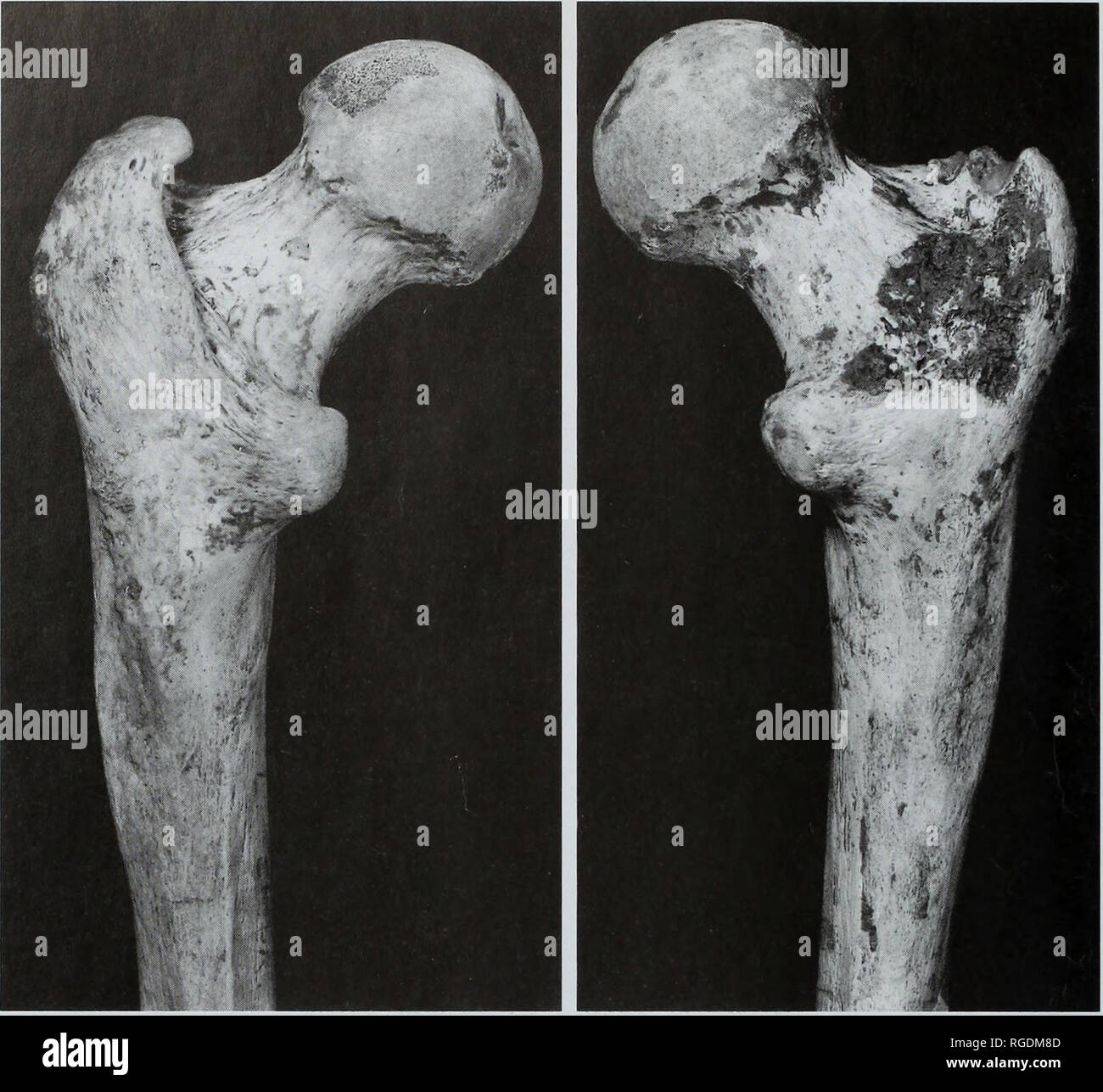 . Bulletin der natürlichen Histort Museum. Geologie Serie. 10 E.TRINKAUS. Abb. 8 Proximo - hintere Ansicht der Gough Höhle 1 femora: x 0,8 (Erweiterung der Fig. 6. oben rechts). Tabelle 8 Querschnittsfläche Maßnahmen der Gough Höhle 1 femoral diaphyses (mm2). 20 % Gesamtfläche (TA) 20% kortikalen Bereich (CA) 20% Medulläres Bereich (MA) 35 % Gesamtfläche (TA) 35% kortikalen Bereich (CA) 35% Medulläres Bereich (MA) 50 % Gesamtfläche (TA) 50% kortikalen Bereich (CA) 50% Medulläres Bereich (MA) 65 % Gesamtfläche (TA) 65% kortikalen Bereich (CA) 65% Medulläres Bereich (MA) 80 % Gesamtfläche (TA) 80% kortikalen Bereich (CA) 80% Medulläres Bereich (MA) R Stockfoto