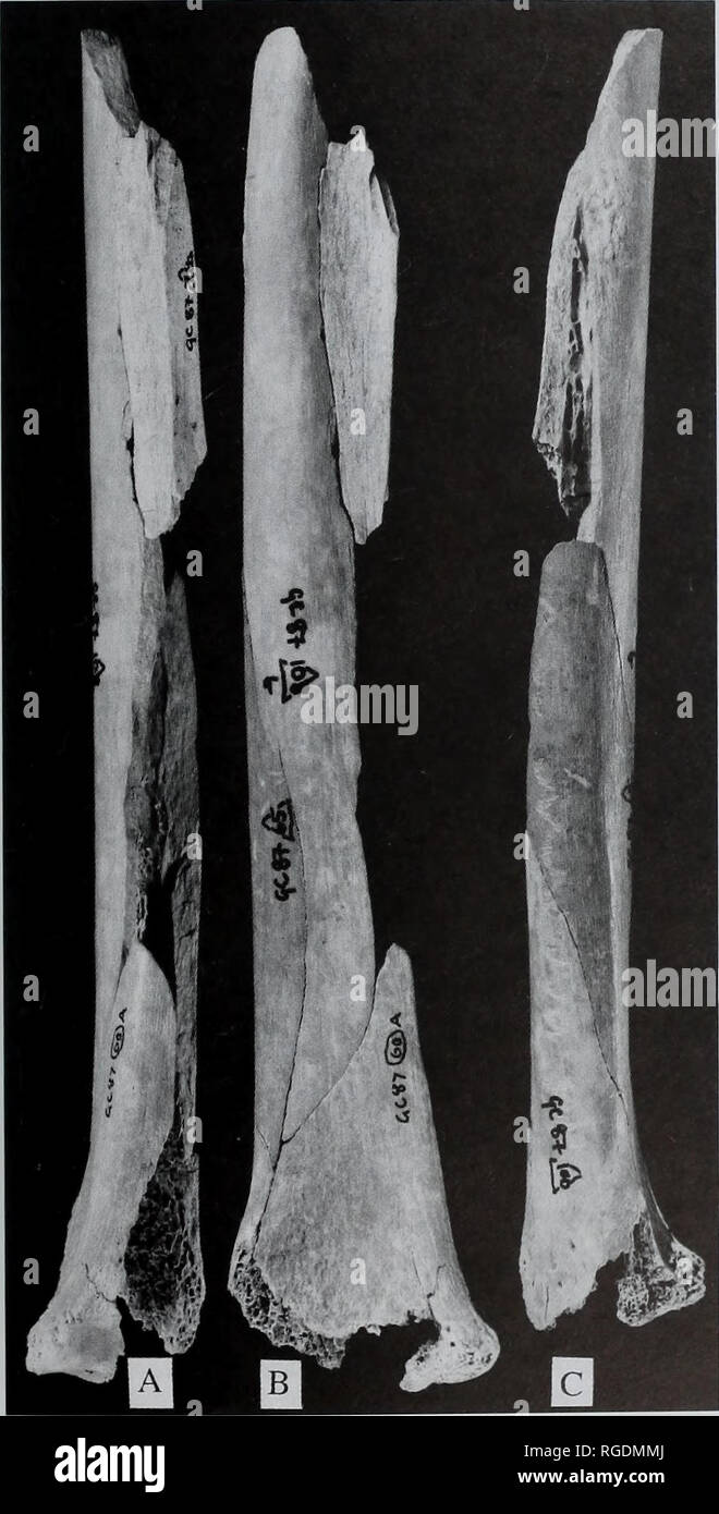 . Bulletin der natürlichen Histort Museum. Geologie Serie. CRESWELLIAN MENSCHEN bleibt der oberen Extremität 21 Tabelle 10 Vergleichende rechts ulnaren Mitte der proximalen Querschnitt geometrischen Eigenschaften. Radiale BLEIBT M. 5406 Gough's Cave ich Gesamtfläche (TAXmm^) kortikalen Bereich (CA) (mm) medulläre Bereich (MA) (mm) AP 2 Moment der Bereich (ICH^) (MNI"*) ML 2 Moment der Bereich (ICH^) (mm) Max. 2. Zeitpunkt der Bereich (ICH,,,^^) (mm^) Min. 2. Zeitpunkt der Bereich (l^^^ j (mm"*) Polar 2 Moment der Bereich (J) (mm^) Prozent kortikalen Bereich (% CA) in'n 208,7 143,0 176,0 131,3 32,7 11,7 3641.9 1632.5 3529.8 1920.1 4048.3 2096.7 312 Stockfoto