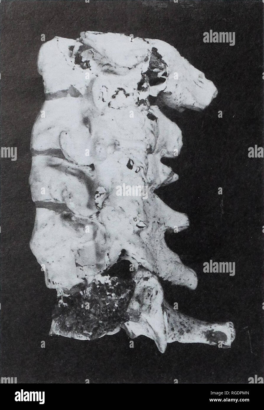 . Bulletin der natürlichen Histort Museum. Geologie Serie. . S.E. CHURCHILL UND T.W. HOLLIDAY Tabelle 1 Abmessungen (mm) der sechsten Halswirbel. Dorso-ventrale Durchmesser 1 Superior externe quer Gelenkknorpel Durchmesser 3 Superior interne quer Gelenkknorpel Durchmesser 1 Superior transverse Gelenkknorpel Durchmesser 4 Minderwertige externe quer Gelenkknorpel Durchmesser 5 Minderwertige interne quer Gelenkknorpel Durchmesser 6 Minderwertige quer Gelenkknorpel Durchmesser "Wirbelkanal dorso-ventrale Durchmesser (M-10) Wirbelkanal quer Durchmesser (M-l1) Dornfortsätze Prozess Länge 8 Dornfortsätze Prozess Winkel 1 * Körper ventral Höhe Stockfoto