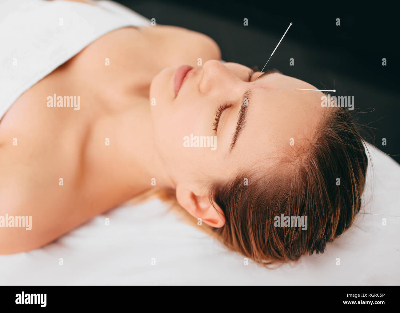 Schöne Frau mit Akupunktur Nadeln auf den Kopf. Chinesischen Behandlung mit Nadeln einen Energiefluss durch spezifische Punkte auf der Haut wiederherzustellen. Stockfoto