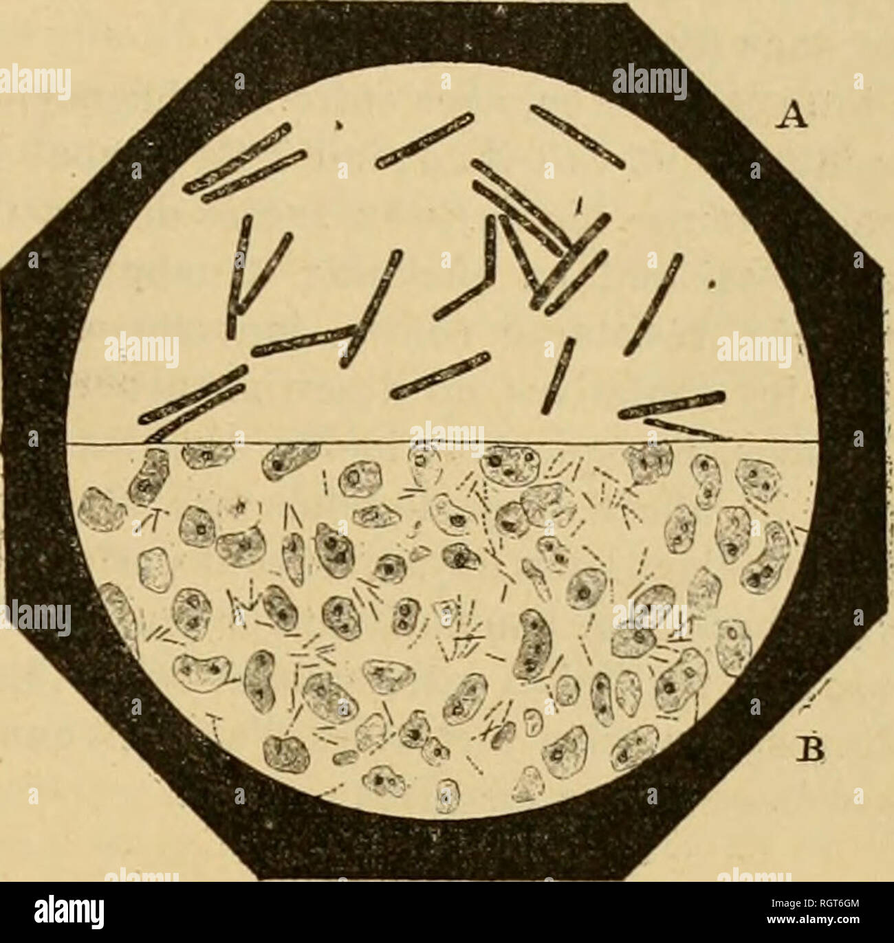 . Bulletin biologique de la France et de la Belgique. Biologie; Natural History. D'H. VINCENT. "LES TUBERKELN ET LE BACILLE DE LA TUBERCULOSE 659 LES TUBERKELN ET LE BACILLE DE LÃ TUBERCULOSE Les travaux de M. MetclinikotT ont introduit en Pathologie Générale cette Vorstellung, aujourd'hui bien Dekor montrÃ©e, que parmi les moyens de Dekor fense nicht entsorgen Notre organisme inliniment pour Lutter contre les Petits qui l'assiÃ ¨ Gent, l'activitÃ© di-gestive des cellules Vivantes à l'Ã©Gard des Mikroben remplit un rÃ'le trÃ¨s wichtig". Cette Funktion protectrice si Curieuse est Einrichtung volue à des Ã©lÃ© Stockfoto