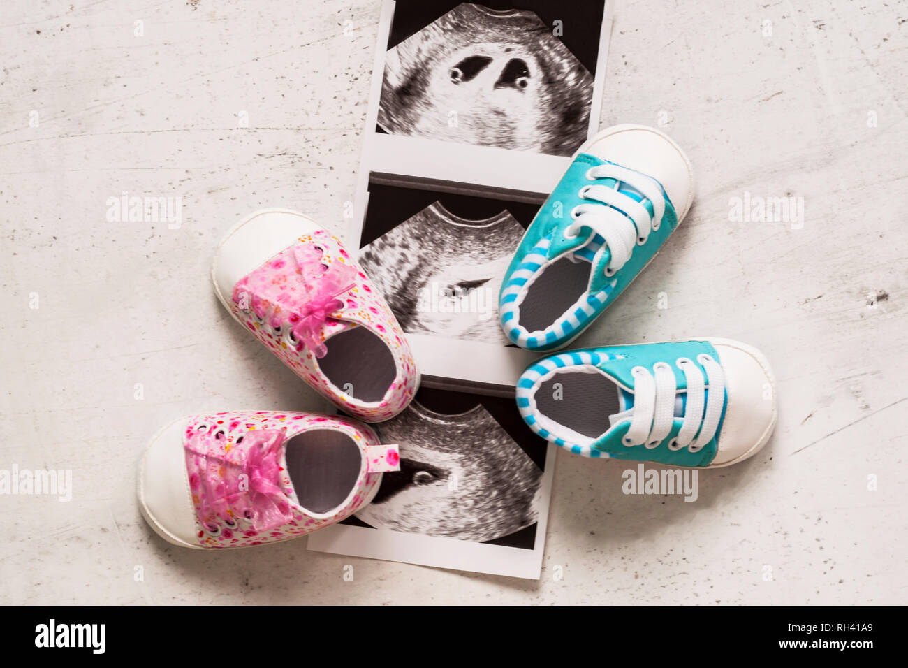 Blau und pink Booties neben Baby Fotos mit Ultraschall in der 4. Woche der Schwangerschaft. Warten auf Zwillinge. Sohn und Tochter. Selektiver Fokus Stockfoto