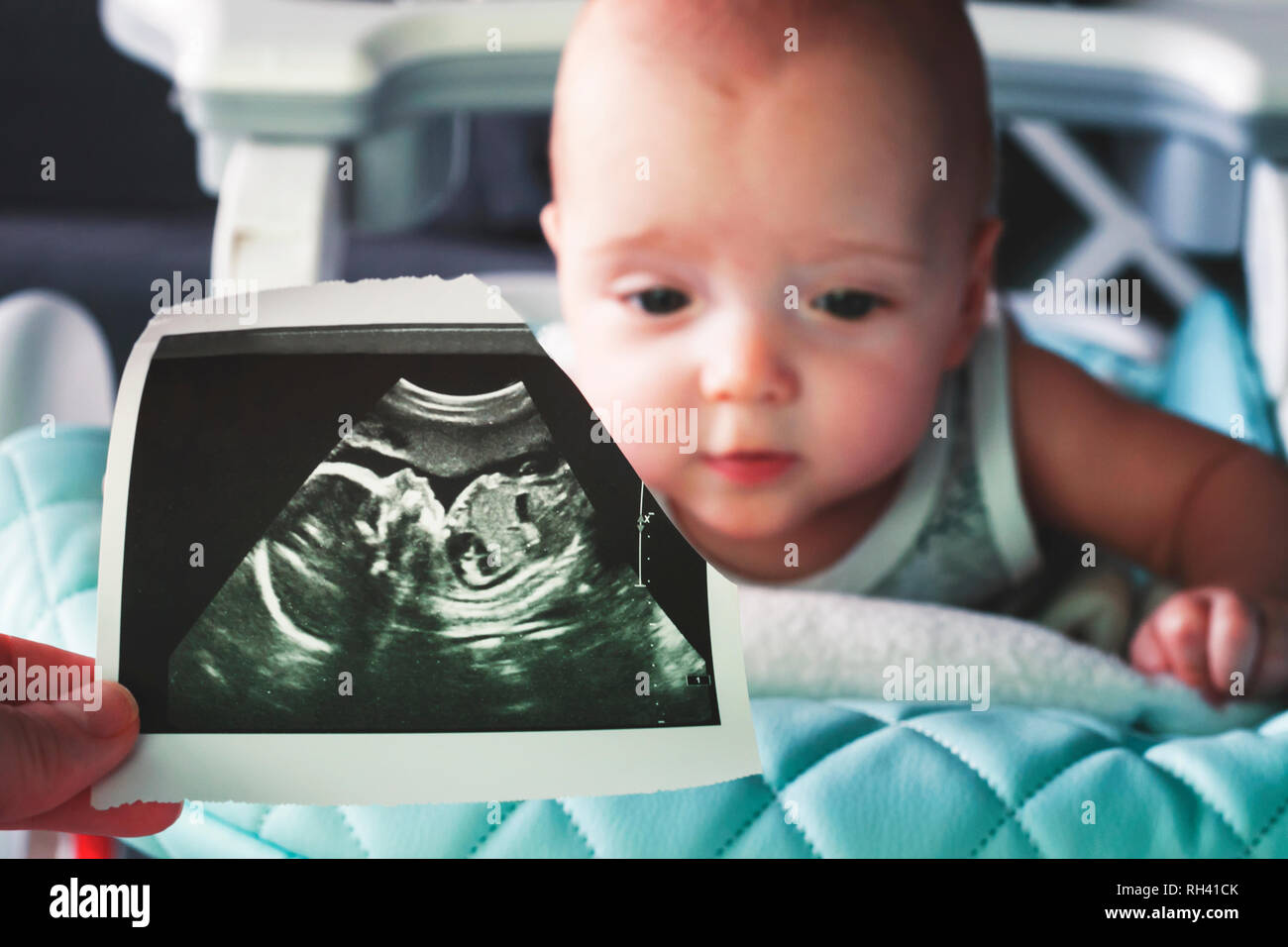 Ultraschall Bild in der 20. Woche der Schwangerschaft im Vordergrund. Im Hintergrund ist ein 6 Monate altes Baby. Vor und jetzt. Selektiver Fokus Stockfoto