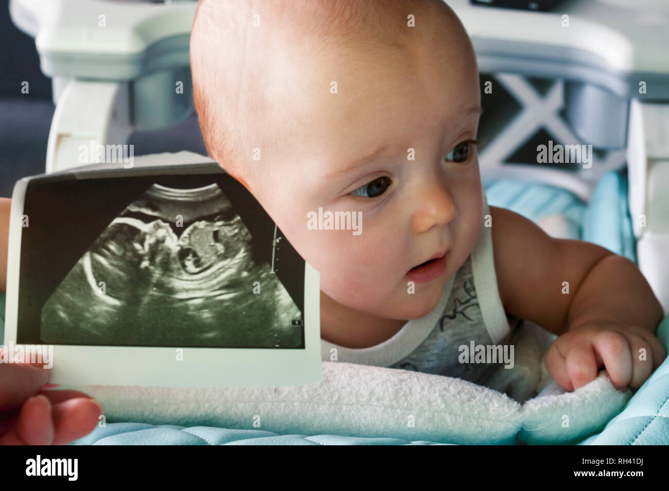 Ultraschall Bild in der 20. Woche der Schwangerschaft im Vordergrund. Im Hintergrund ist ein 6 Monate altes Baby. Vor und jetzt. Selektiver Fokus Stockfoto