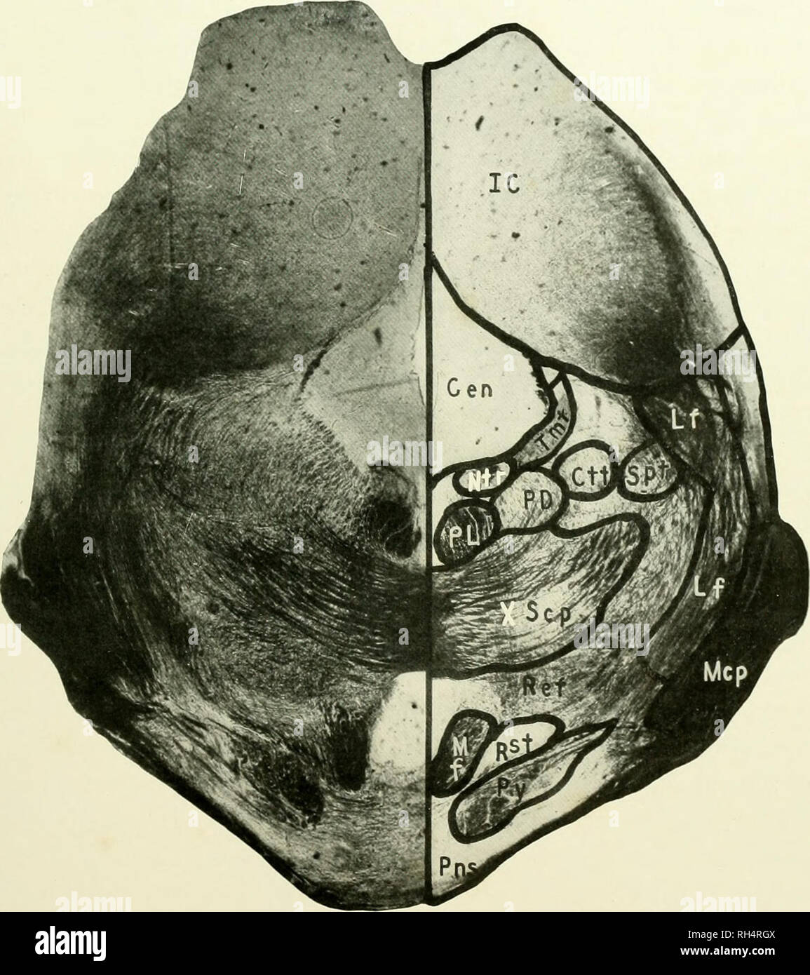 . Das Gehirn vom Affen zum Menschen; ein Beitrag zur Untersuchung der Entwicklung und der Entwicklung des menschlichen Gehirns. Gehirn; Evolution; Pongidae. Abb. 59. TARSIUS SPECTRUM. Ebene der Colliculus inferior. CEN, Zentrale graue Materie; ctt, zentrale Tegmental Trakt; ic. Inferior Colliculus; lf, seitliche Verrundung, mf, Mesialen Filet; mcp, Naher cerebelläre Stiel; ntr, Nucleus Troclilearis; Pd, Predorsal Bundle; PL, Posterior longitudinalen Fasciculus; pns, Pons; pv. Pyramide; Ref, retikuläre Formation; rst, Rubrospinal Trakt; SPT, Spinothalamic Tract, TMT, Mesencephalic Wurzel des Fünften Nerv; xscp. Der Decussation Stockfoto