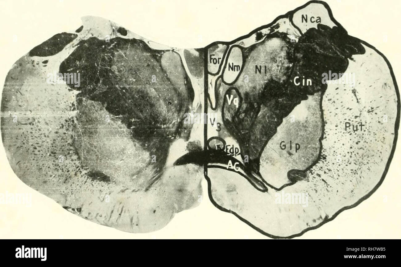 . Das Gehirn vom Affen zum Menschen; ein Beitrag zur Untersuchung der Entwicklung und der Entwicklung des menschlichen Gehirns. Gehirn; Evolution; Pongidae. 684 Die fUGHER Menschenaffen Prozess der dic'rgcnc 't'-Merkmal ol am oberen Ende ol das Stammhirn, durch die die hbers die beiden zerebralen pechiiicles cstabhsh ultimative Beziehungen mit den beiden hirnhemisphären constitiitiiig.. Abb. 311. GORILLA. Ebene der ANTERIOK COMMISSURE. AC. Aiinriur CJommissiiiv; KANN, inneren Kapsel; IDI>, Absteigend Säulen der Fornix Fornix; lOR,; Glp. Globus pallidus; nca caudate Kern; NL, seitliche Kern der Tha Stockfoto