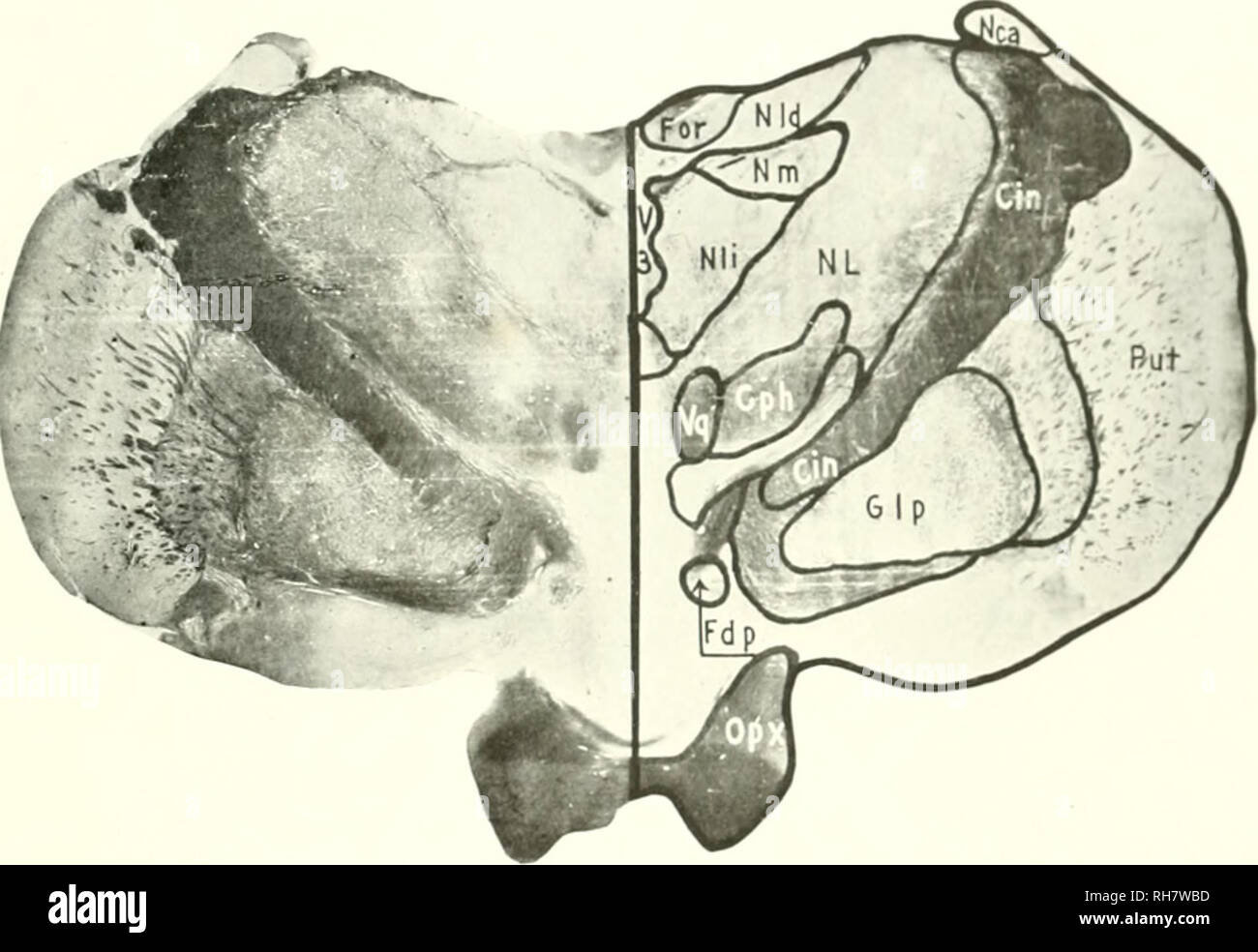 . Das Gehirn vom Affen zum Menschen; ein Beitrag zur Untersuchung der Entwicklung und der Entwicklung des menschlichen Gehirns. Gehirn; Evolution; Pongidae. TROGLODYTES GORILLA 683 LEEL DES OPTIC CHIASMA (Eig. 3 IO) Auf dieser Ebene eine deutliche ehan< i; i" im Überblick über den Abschnitt wird durch das Auftreten von tlie dritten Ventrikel i'3 festgelegt) und die beiden Optic thalami..r-TG. 310. GOKILI. A. Ebene DER OPTIC CHIASMA. ciN, inneren Kapsel; cph, Corpus Hypothaiamicuni; rni", Desci - ndin ({Säulen iif Zinn - Fornix; ich ok, Fornix: GLP, Globus Palliclus; nca caudate Kern; nl. Seitliche Kern des Thalamus Stockfoto