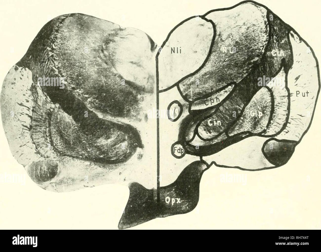 . Das Gehirn vom Affen zum Menschen; ein Beitrag zur Untersuchung der Entwicklung und der Entwicklung des menschlichen Gehirns. Gehirn; Evolution; Pongidae. 6 o6 DER HÖHEREN Menschenaffen mit den zerebralen Stiel bilden die seitliche hoiindary Der optico-pedun- Raum. Die Optik bieten die thalanii iinj:) () rtant Relais Stationen im patiiway aller Arten von Sensibilität m it dem Pe |)tion des Olfaktorischen. Abb. 20. Schimpansen. Ebene DER OPTIC CHIASMA. riN, interne CJapsulc; idi', Absteigend Säulen der Fornix; n> UHR, Corpus Ilypothalamicum; olp. Globus pallidus; nl. Seitliche Kern des Thalamus; mi. Int Stockfoto