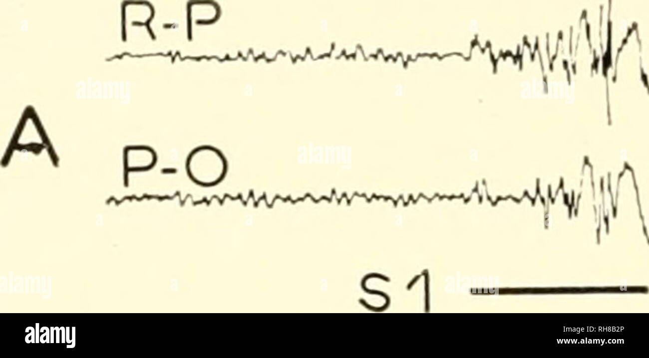 . Gehirn Mechanismen und Lernen, ein Symposium. Psychophysiologie; Lernen, Psychologie der. 632 GEHIRN MECHANISMEN UND LERNEN. B C D 1'' 11/IVNiWiW i, ^j^' S 16 S 20 Abb. 3 Modifikationen dcs Spuren dans I'Espace de temps qui Vorausgehen ini-nicdiatenicnt['application du Stimulus inconditionnel, Chez un Sujet dc 20 ans presentant unc epilcpsie de Typ 'Petit Mai Abwesenheit" favorisee spontance et par la lumierc. Kalibrierung: Amplitude 100 Μv, Vitesse ich cm. 5 par Seconde. Enregistrement bipolairc. R: rolandique; P: parictale; O: OCCIPITALE; S: Signal. La S.L. ICH, est representee par un Trait noir Co Stockfoto