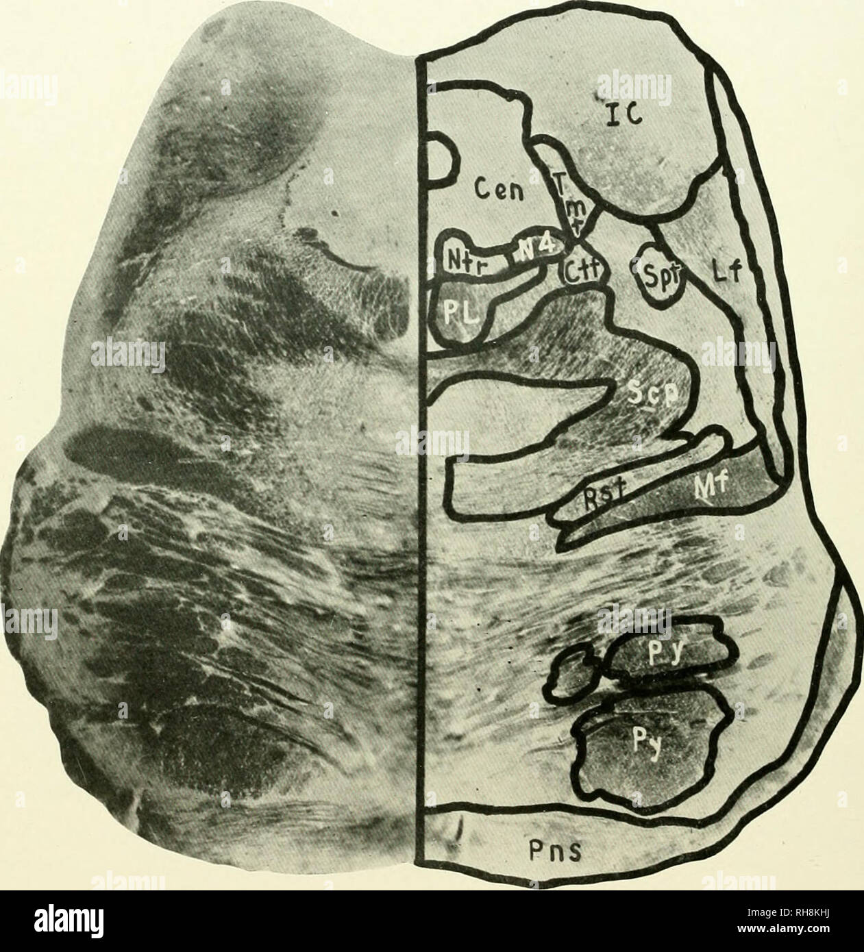 . Das Gehirn vom Affen zum Menschen; ein Beitrag zur Untersuchung der Entwicklung und der Entwicklung des menschlichen Gehirns. Gehirn; Evolution; Pongidae. 440 DIE MITTLERE PRIMATEN Kern trochlearis (Ntr), aus der die vierte Hirnnerven entsteht (N4). In den seitlichen Rand des zentralen graue Materie sind die verstreuten bündelt die Bildung der Tractus mesencephalicus trigemini (TMT), während in einem ventralen. Abb. 208. GIBBON. Ebene der Colliculus inferior. CEN, Zentrale graue Materie; ctt. Zentrale Tegmental Trakt; ic. Minderwertige CoIIiculus; lf. Seitliche Verrundung; mf> Mesialen Filet; ntr, trapezförmigen Kern; N4, Trochl Stockfoto