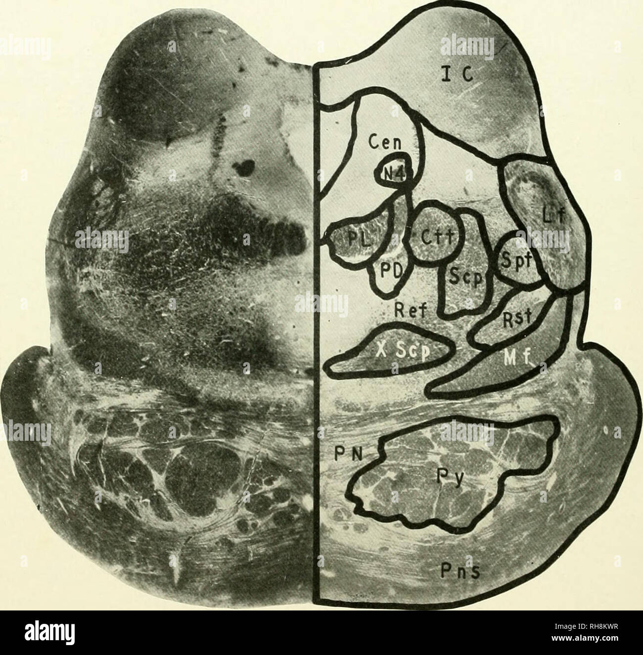 . Das Gehirn vom Affen zum Menschen; ein Beitrag zur Untersuchung der Entwicklung und der Entwicklung des menschlichen Gehirns. Gehirn; Evolution; Pongidae. 384 DIE MITTLERE Primaten. In seiner lateralen Teil sind mehrere dichten Bündel von myelinized Axone, die den absteigenden Fasern Der trochlea Nerv (N4) wie sie nach unten auf der Ebene ihrer linal decussation vor Auftauchen aus. Abb. 100. MACACUS. Ebene OI UlL IMLKIOK COLLICULUS. CEN, Zentrale graue Materie; ctt. Zentrale Tegmental Trakt; ic, Inferior Colliculus; lf, seitliche Verrundung; mf. Mesialen Filet; N4, trochlea Nerv; Pd, Predorsal Bu Stockfoto
