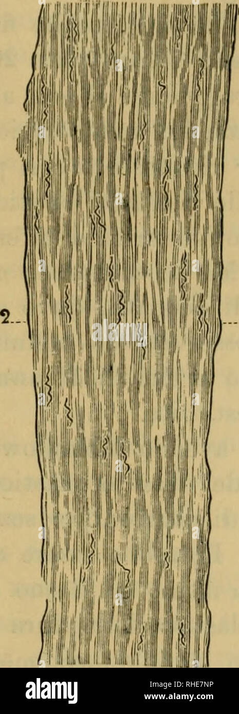 . Bollettino della Società dei naturalisti in Napoli. Natural History; Naturgeschichte; Geologie; Wissenschaft; Paläontologie. Abb. 5bis.-Dura di vol-ta d'Uomo Di 15 anni. 1. Limitante elastischem in-terna. 2. Limitante elastischem e-sterna.. Abb. 9. - Dura di Volta d'Uomo Di 75 anni. 1. Limitante elastischem in-terna. 2. Limitante elastischem e-sterna. Normale delle limitanti elastiche della Dura cranica 16 anni, l'altro che col Progresso degli anni nicht cresce Il tessuto elastico meningeo, kommen si scorge in Queste durch Abbildung (figg. 5 e 9); La Abb. 5 appartiene ad un individuo Di 16 anni e la Abb. 9a Stockfoto