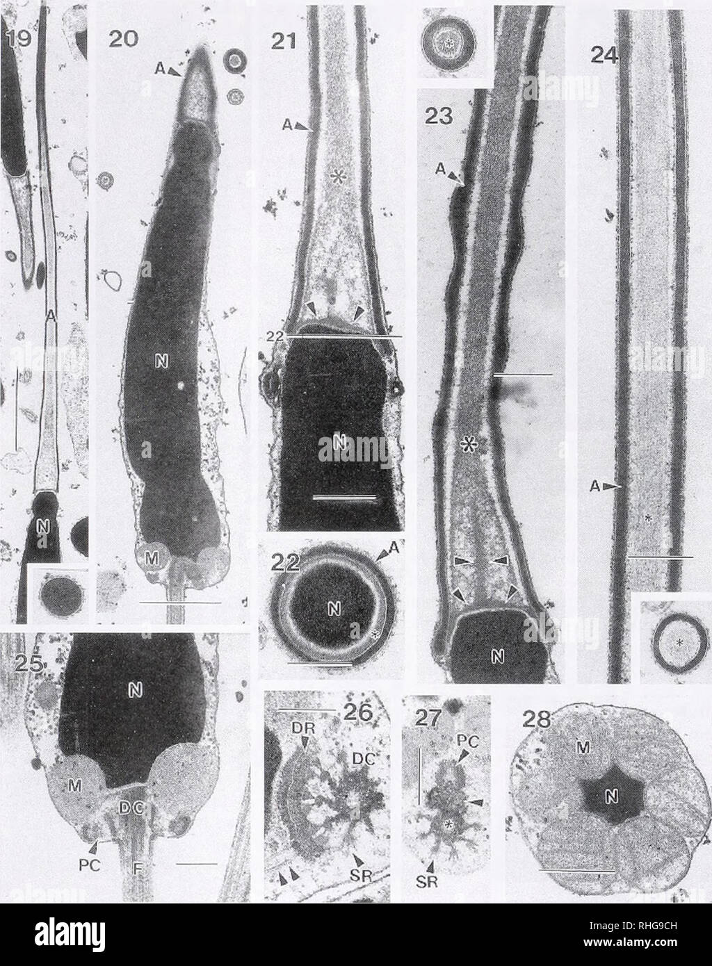 . Die biologische Bulletin. Biologie; Zoologie; Biologie; Meeresbiologie. 140 K. J. ECKELBARGER UND C.M.JUNG. Abbildung 19. Reifen spermalo/oon zeigen längliche Akrosoms (A) und Kern (N). Einfügen zeigt Querschnitt durch anteriore Region Akrosoms. Scale=3.0/j, m. Abbildung 20. Kernenergie (N) Region des Spermatozoons mit beweidung Abschnitt der anterioren ucrosomul Vesikel (A). M. Mitochondrium. Scale=2.0 jj, m. Abbildung 21. Seitenzahnbereich oder Akrosomale Vesikel (A) zeigt die Fläche subacrosomal ot dichten Basalplatte (pfeilspitzen) und flocculem Innenraum (*). Scale=1.5/Urne. Abbildung 22. Tr Stockfoto