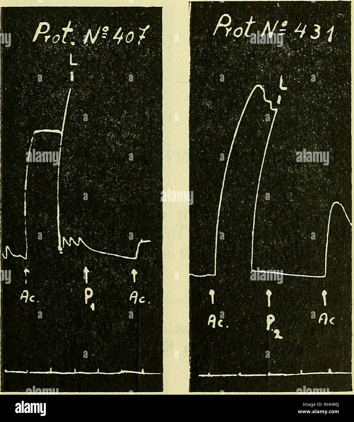 . Boletin de la Sociedad de Biología de Concepción. Sociedad de Biología de Concepción; Biologie; Biologie. CUADRO RESUMEN Nr. 3 Porcentaje de recuperación Media en distintas Concentra - ciones de clorhidrato de en papaverina metabolitos Tyrode Sünde ein Los sesenta segundos. Estímulo microgramos acetilcolina 28,6%. Dosis de N 9 de recuperación D. Standard papaverina protocolos Media en % del T.M.) (1) (2) (3) (4) 0,00 0,84 0,35 18 98,7 20 80,3 1,92 0,7 18 61,9 0,39 1,4 17 42,1 3,00 2,8 1 21 13,1 1,80. fíotfJi-SOi t t FIGURA N. 9 3 Preparación de intestino aislado de conejo. Ac-Acetilcolina 28.6 Micr Stockfoto