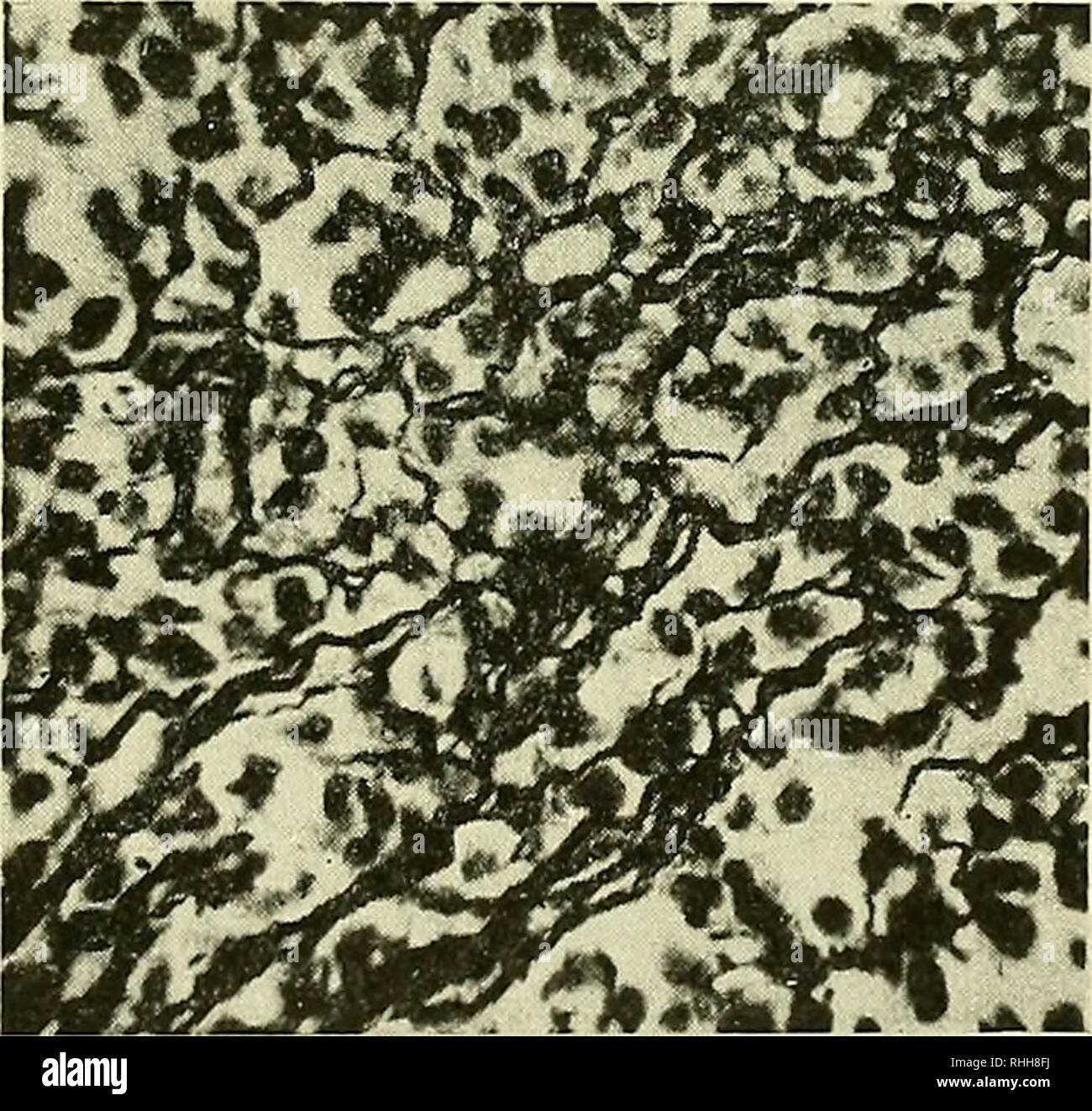 Ganglio linfatico Fotos und Bildmaterial in hoher Auflösung Alamy