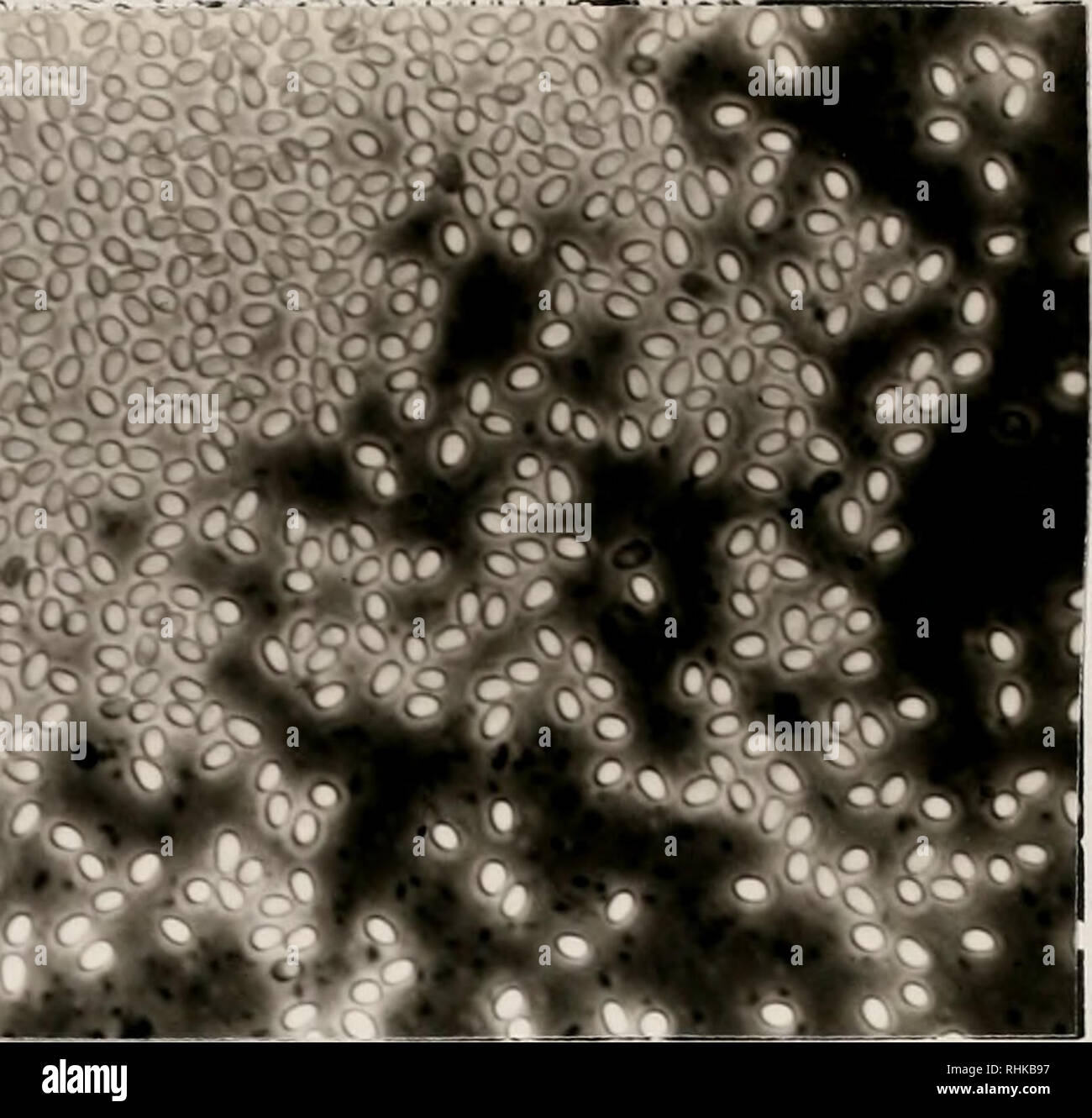 Leishmaniose mensch Fotos und Bildmaterial in hoher Auflösung Alamy