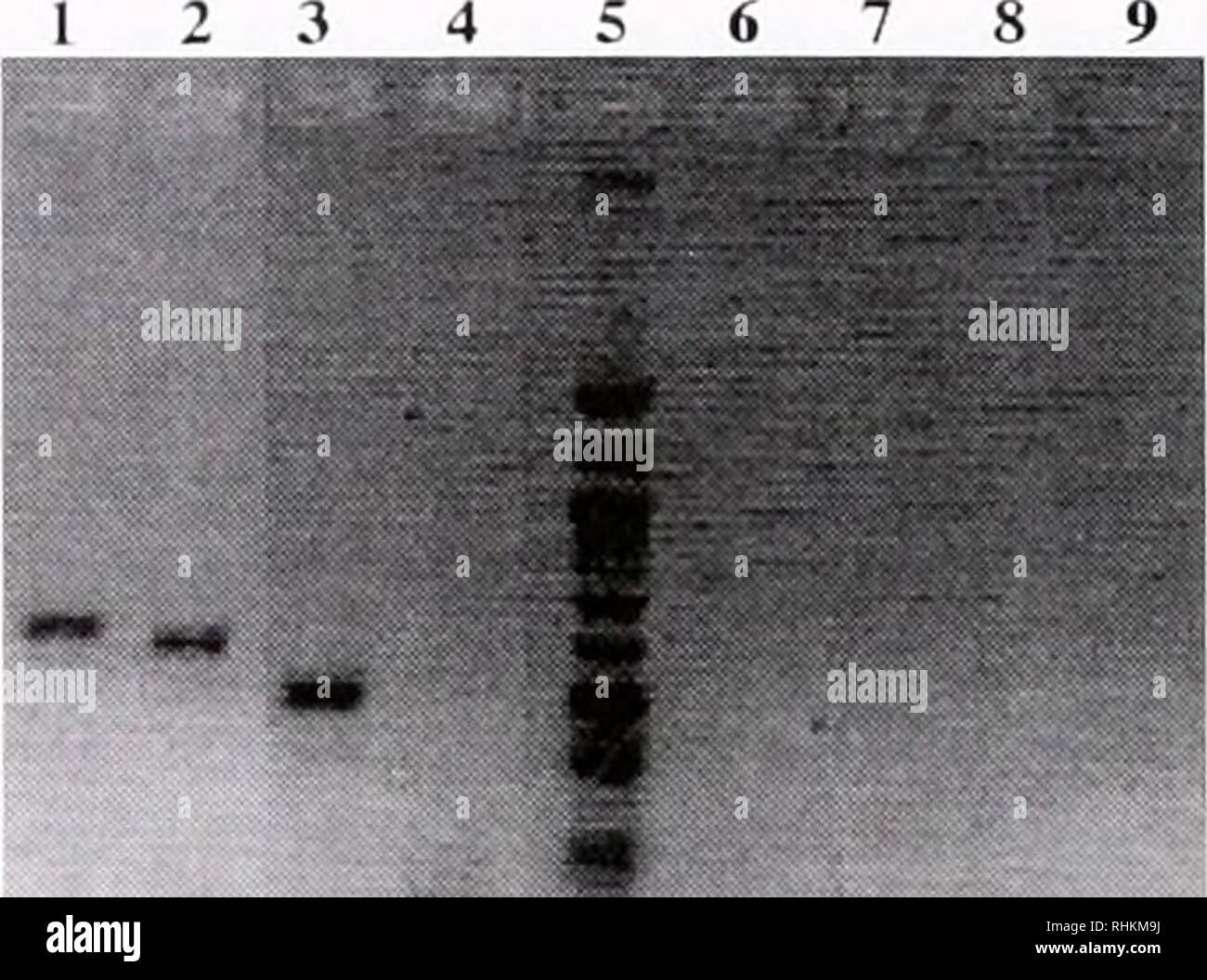 . Die biologische Bulletin. Biologie; Zoologie; Biologie; Meeresbiologie. NIXON ET AL. Tabelle 1 Aktivitäten / Entamoeba histolytica anil Trichomonas aginalix Fe-hydrogencutes Probe Hydrogenase Aktivität (nmol/min/mg Protein)'' Bakterien umgewandelt mit E.histolyticti Fe-hydrogenase Transfizierten E. hixiolytica mit Fe-hydrogenase ich ru humnmis Yu^ nidlis T. viif&gt; inalis + 0,47 mg E.histolyticti Lysat" 36 (2) 3,5 ± 0,7 (3) 167 ± 32 (41 114 (2) eine im Durchschnitt +/- Standardabweichungen, wo möglich. Anzahl der Abschreckung - minations in Klammern. "Ein" = 0,56 mg (Betrag der E.liii Stockfoto