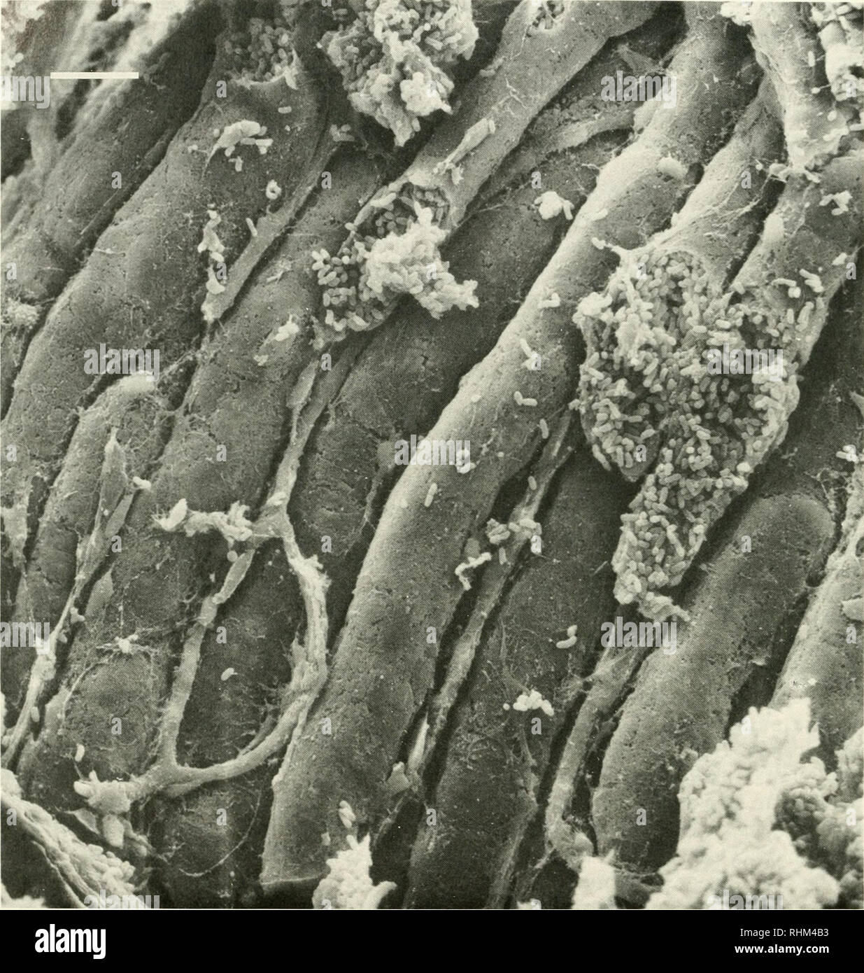 . Die biologische Bulletin. Biologie; Zoologie; Biologie; Meeresbiologie. 416 S. V. DUNLAP. Abbildung 2. SEM von ponyfish {Gazza minuta) Lichtorgel Tubuli, in denen die bakterielle Symbionten {Photobacterium leiognathi). Lichtorgel saccules, offenbar in Vorbereitung der Lichtorgel für SEM zerstört, sind nicht sichtbar. Hinweis die Knappheit der Kapillaren (wie von Bassot 1975 festgestellt) und die Dichte und Einheitlichkeit der Form der bakteriellen Zellen in den Tubuli. Größe bar = 25^m. Fälle wurden nicht beweglich. Mit Hilfe der Methode (Leifson Doetsch, 1981), Färbung für flagellen gab negative Ergebnisse, während die Steuerung Stockfoto