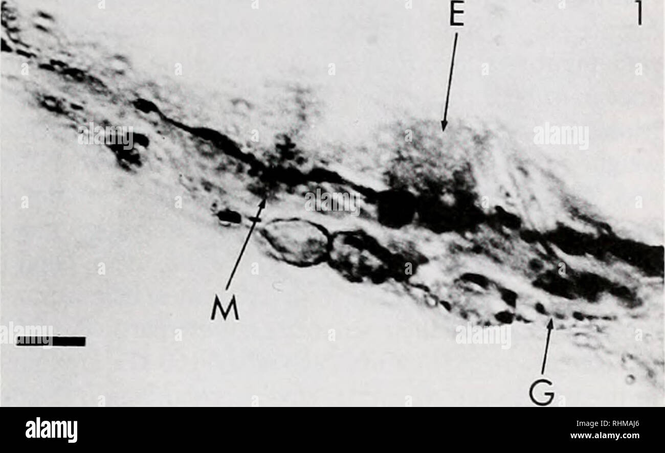 . Die biologische Bulletin. Biologie; Zoologie; Biologie; Meeresbiologie. NEUROFILAMENT-ähnliche Proteine in CNIDARIA 203. Abbildung 1. Der lichtmikroskopie. Querschnitt einer tentakel der Condylactis gigantea, die über bestimmte Nickel - Verbesserte immunostain NF200 mit polyklonalen Antiseren. Das Produkt wird in einen Bereich oberhalb der Muskelschicht und mesoglea enthält die neuralen Plexus lokalisiert. Reaktion ist auch in der gastrodermis gesehen. Der Maßstabsbalken ist 10^m. E, Epidermis; M, mesoglea; G. gastrodermis. von Nervenzellen Gremien und Prozesse (C. DellaCorte, C. Fu-lenwider. D. Hessinger. Und W.O. McClure. Mann Stockfoto